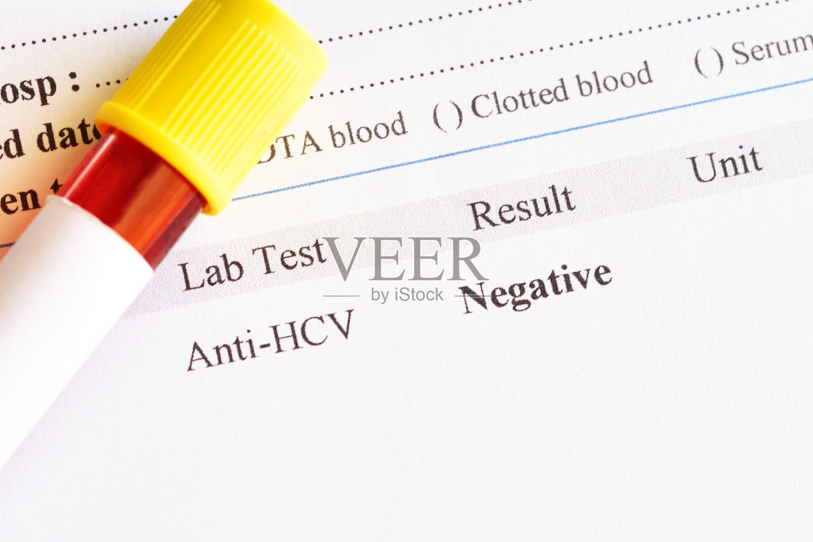 丙型肝炎病毒检测阴性照片摄影图片
