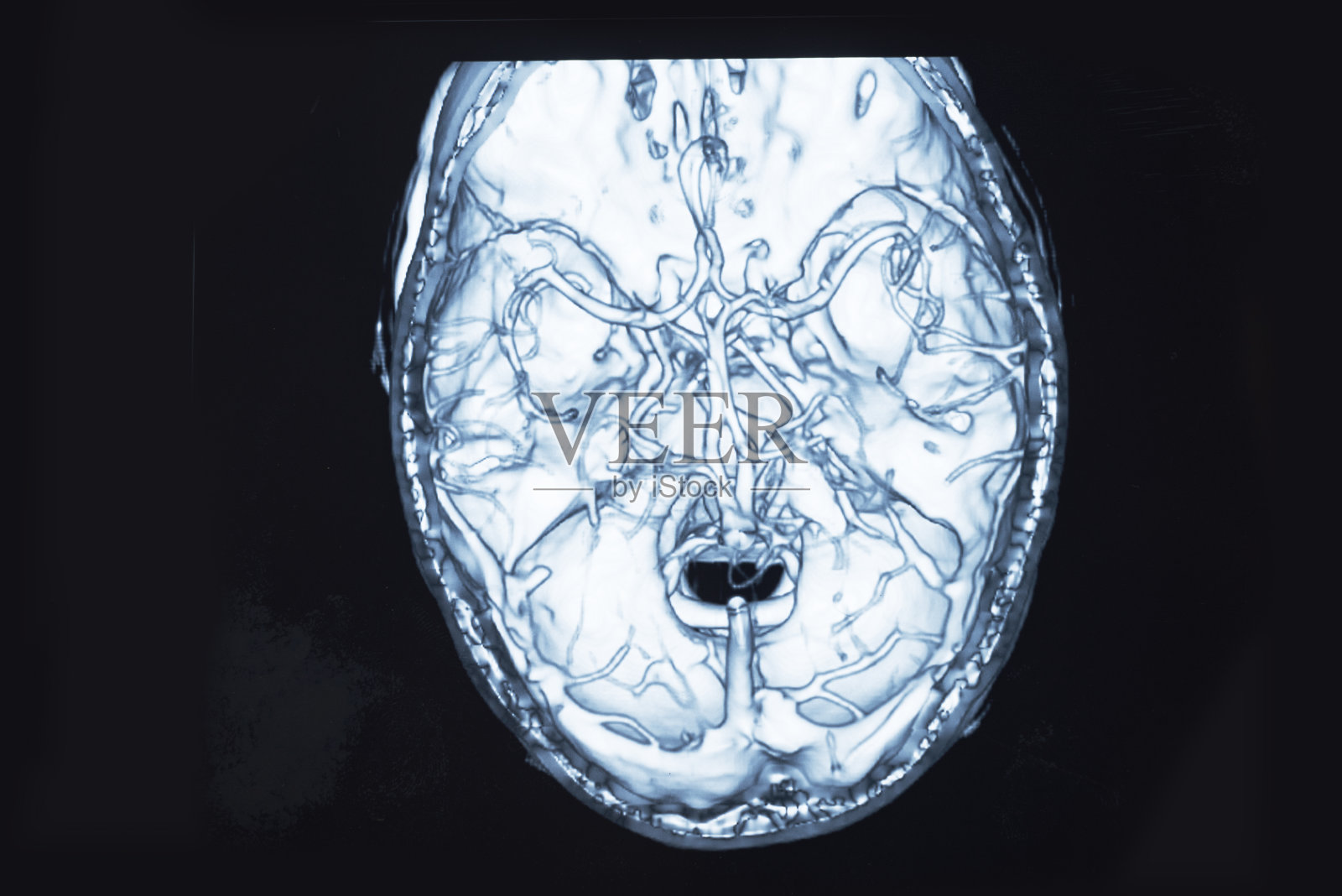 成人腹部x光扫描照片摄影图片