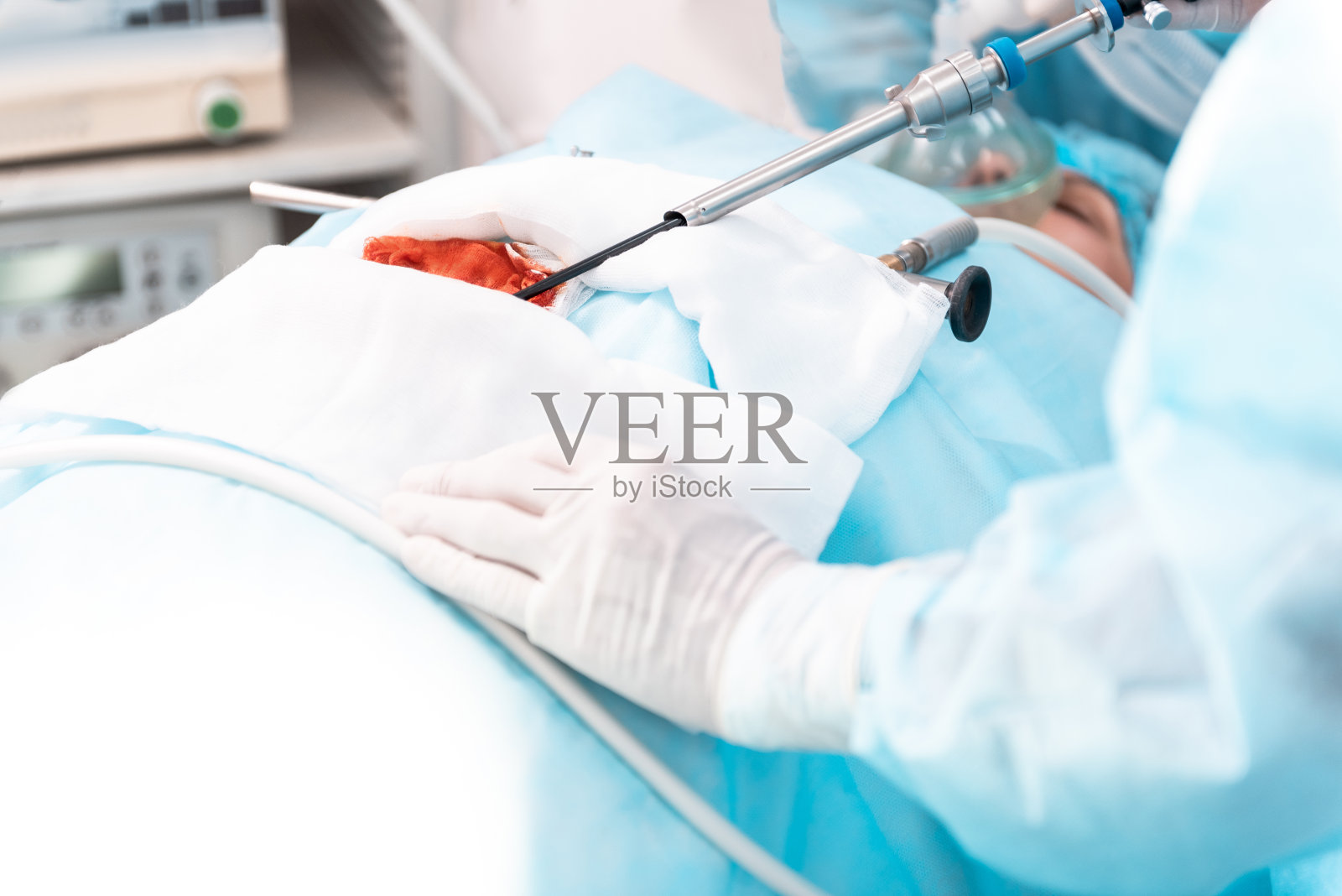 现代仪器对肾脏手术过程的观察照片摄影图片