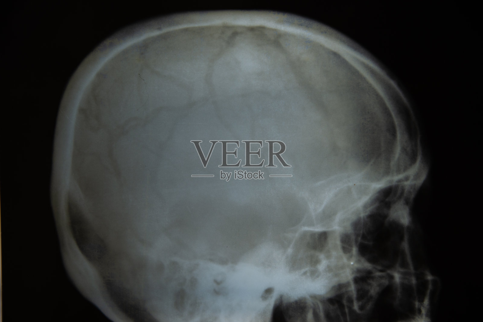 x光的人。照片摄影图片