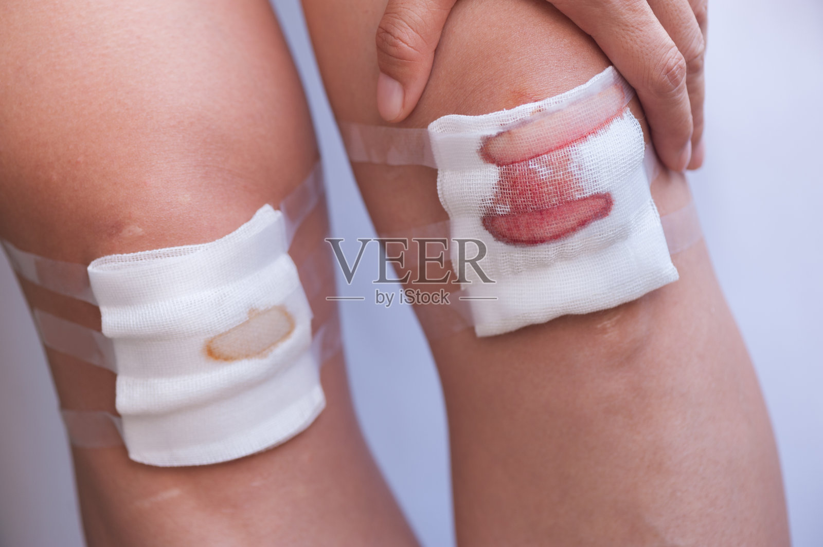 近距离观察擦伤的人体膝盖纱布照片摄影图片