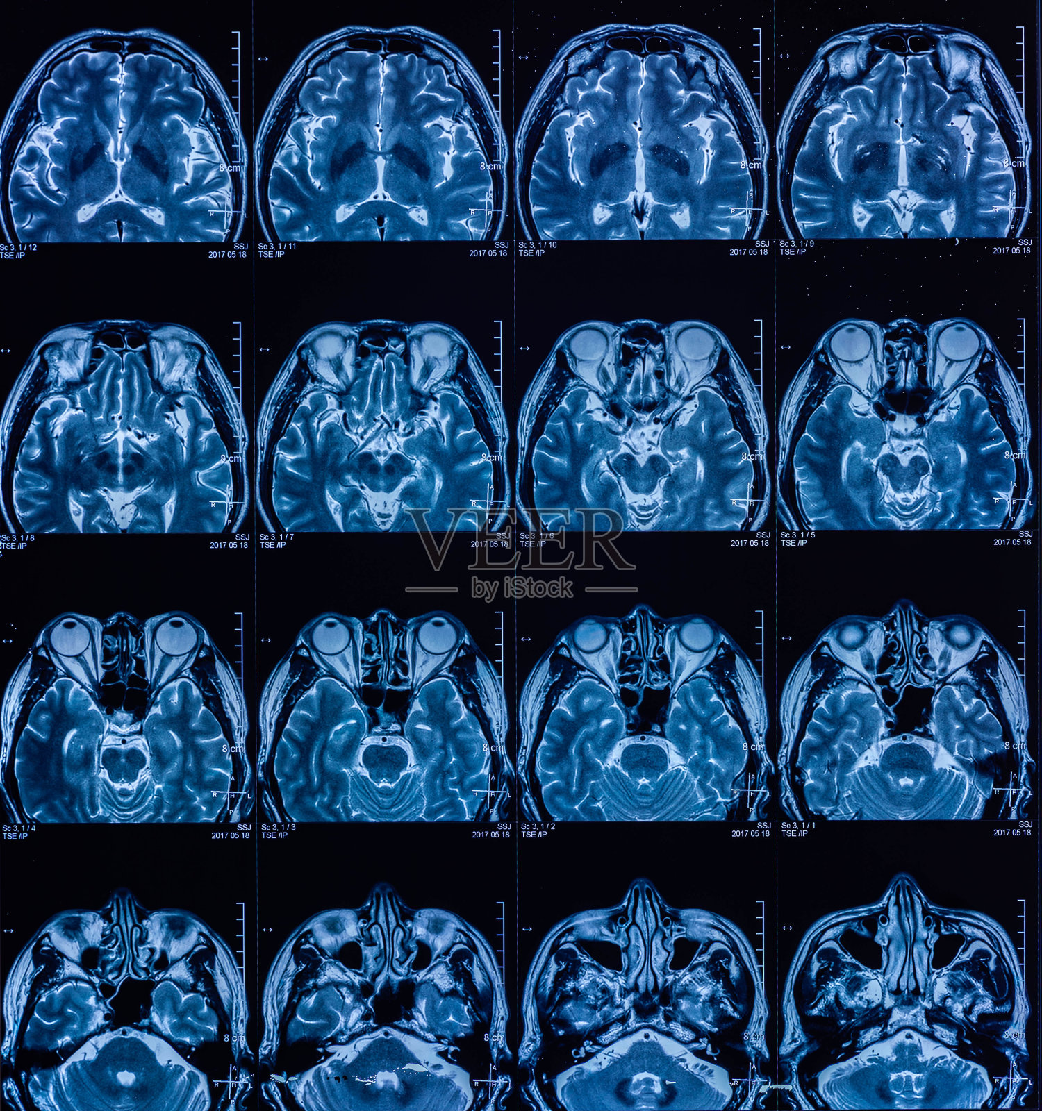 MRI扫描人类头部断层扫描照片摄影图片