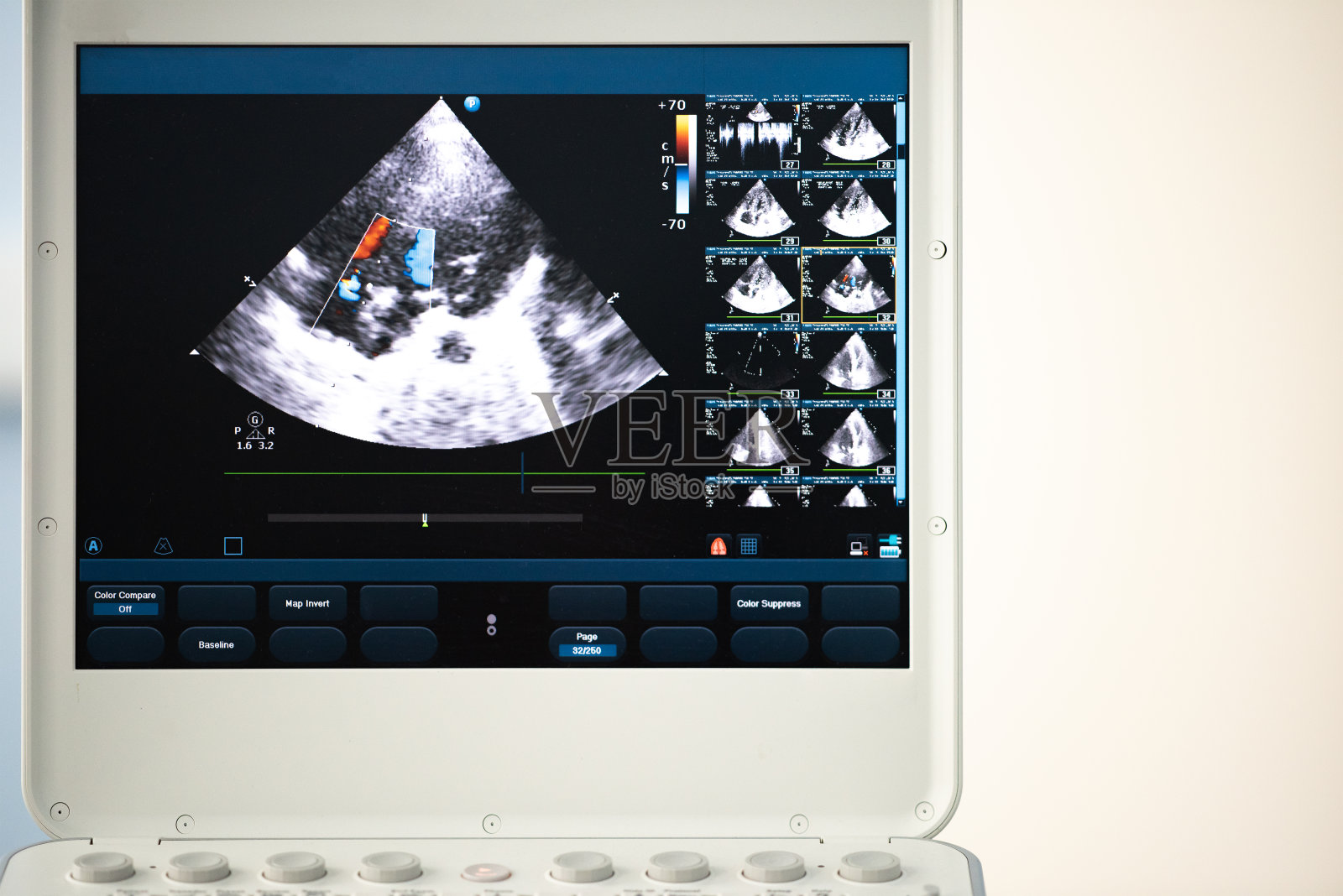 一个带心脏扫描的超声波设备屏幕。多普勒方法显示瓣膜返流。照片摄影图片
