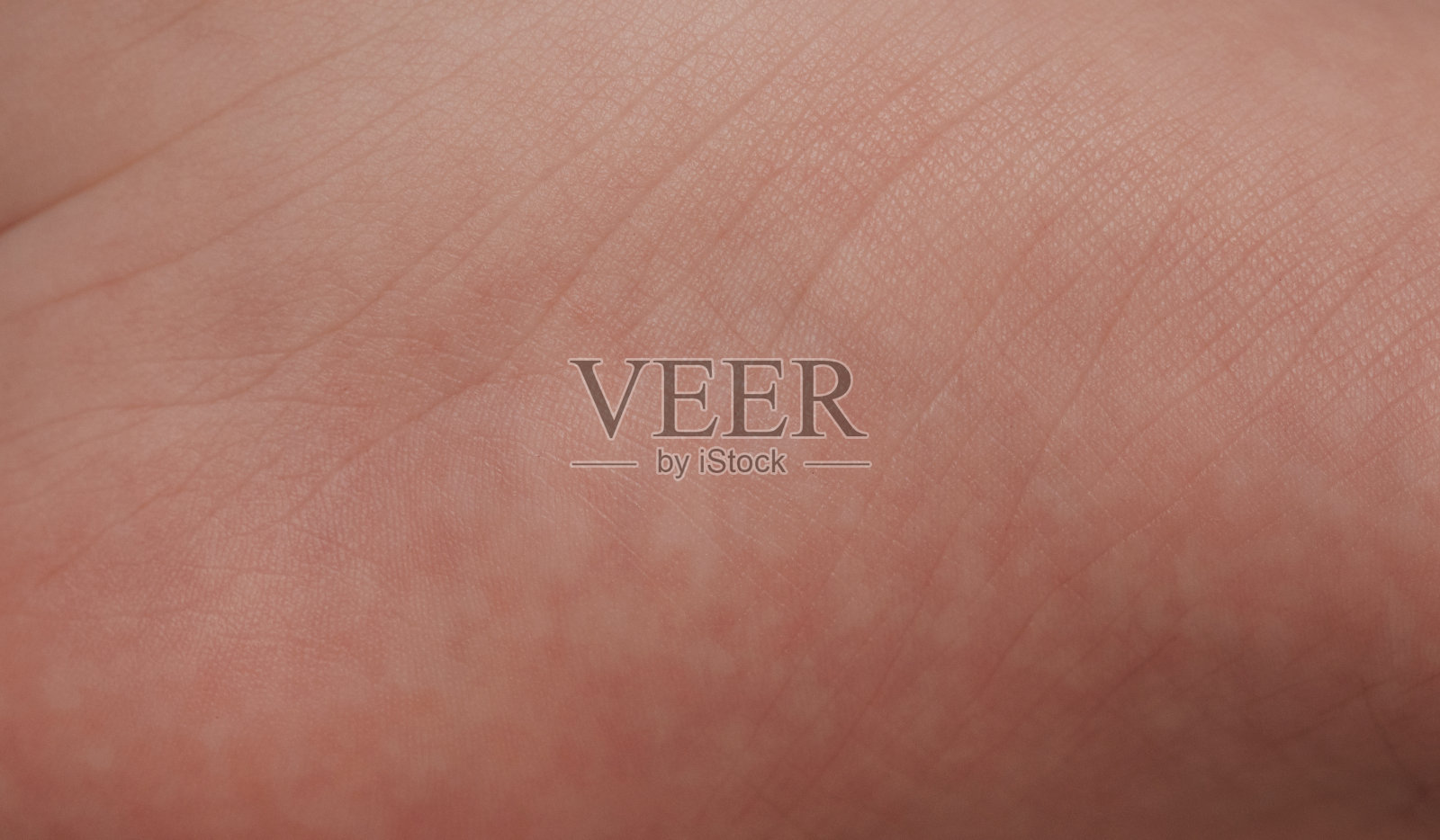 带线条的皮肤纹理照片摄影图片