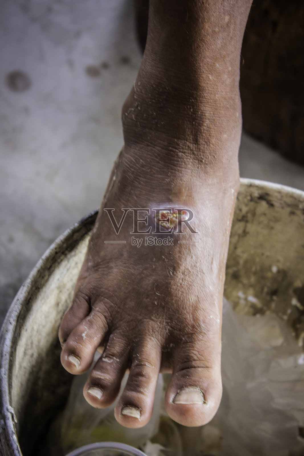 病变照片摄影图片