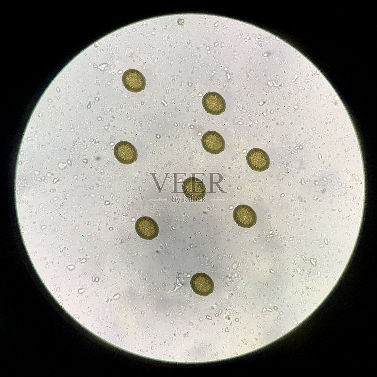在粪便中发现中度带绦虫卵。照片摄影图片