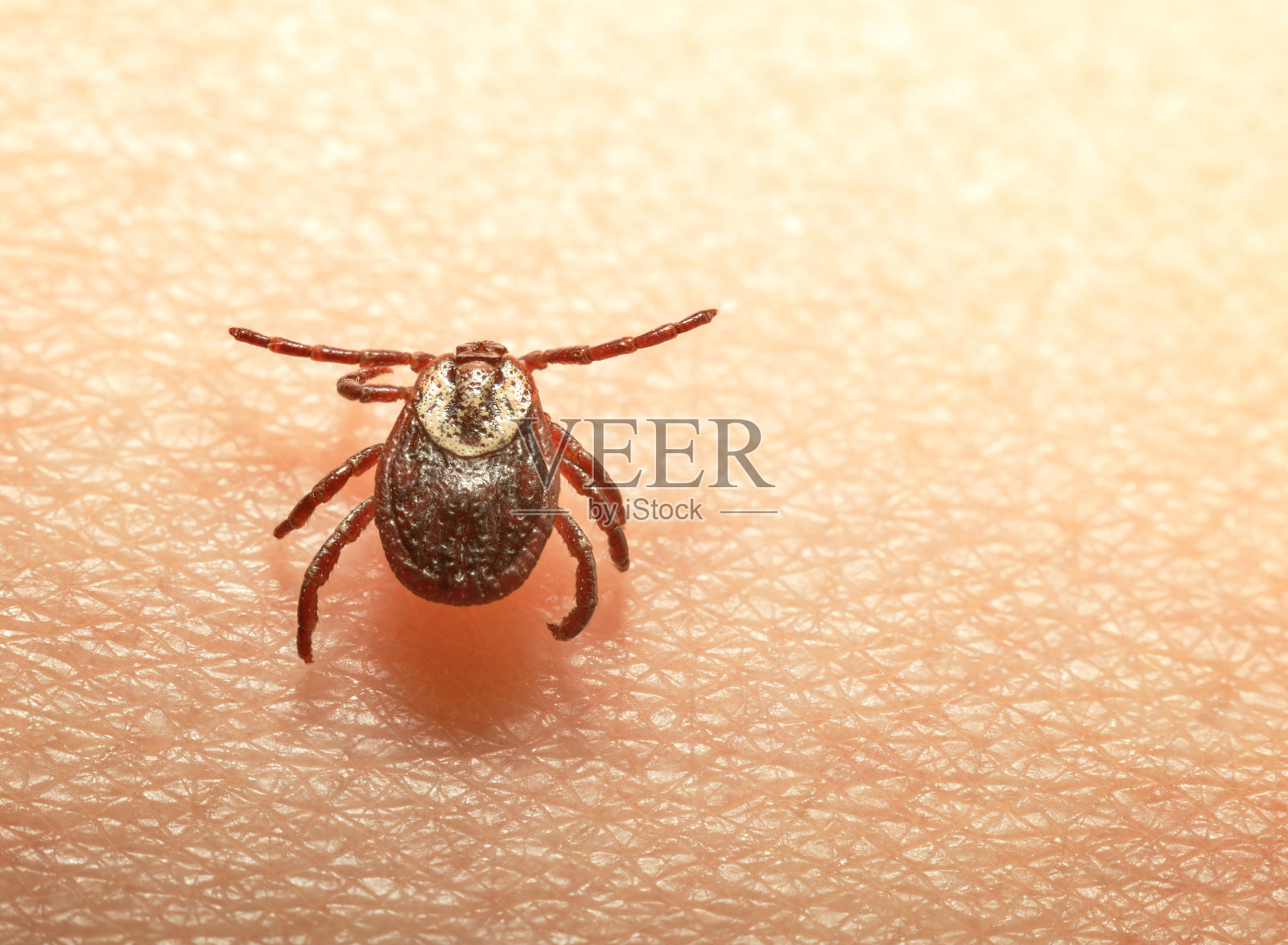 人皮肤上的蜱虫照片摄影图片