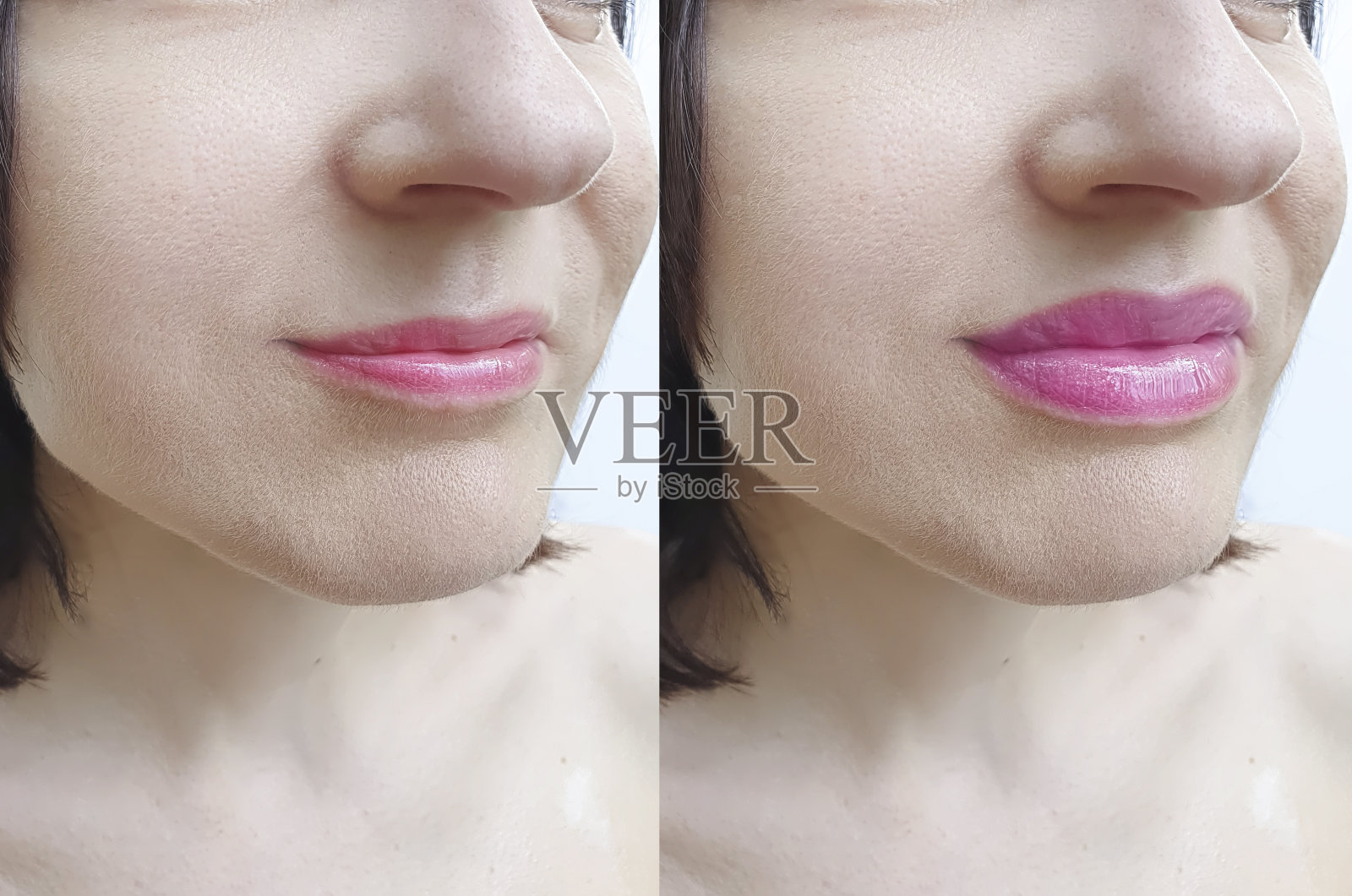 女孩的嘴唇前后扩大照片摄影图片