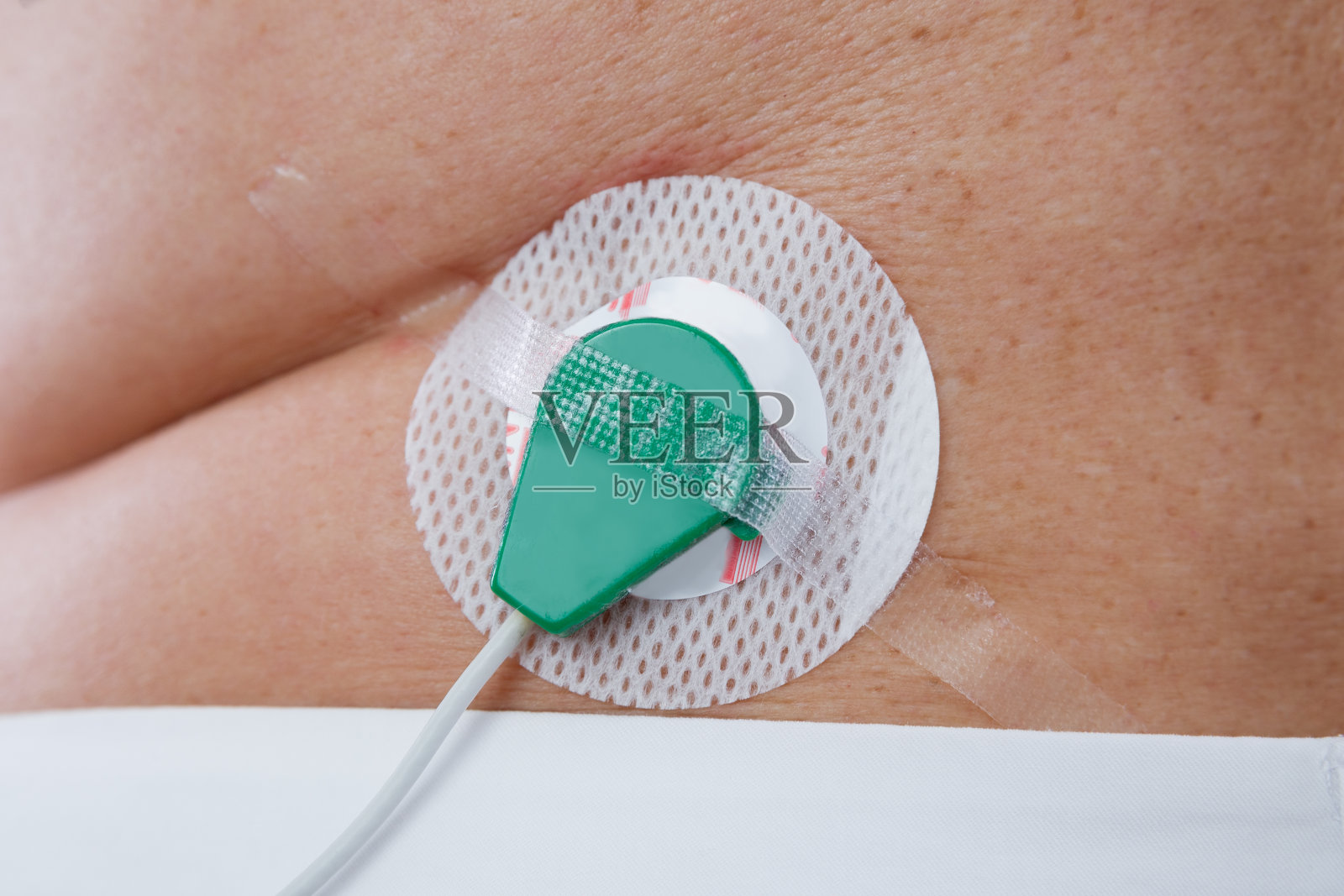 人体上的医用电极照片摄影图片