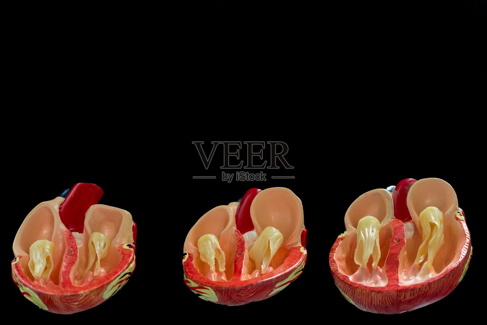 犬心脏模型，正常心脏和DCM心脏，在黑色背景上分离照片摄影图片