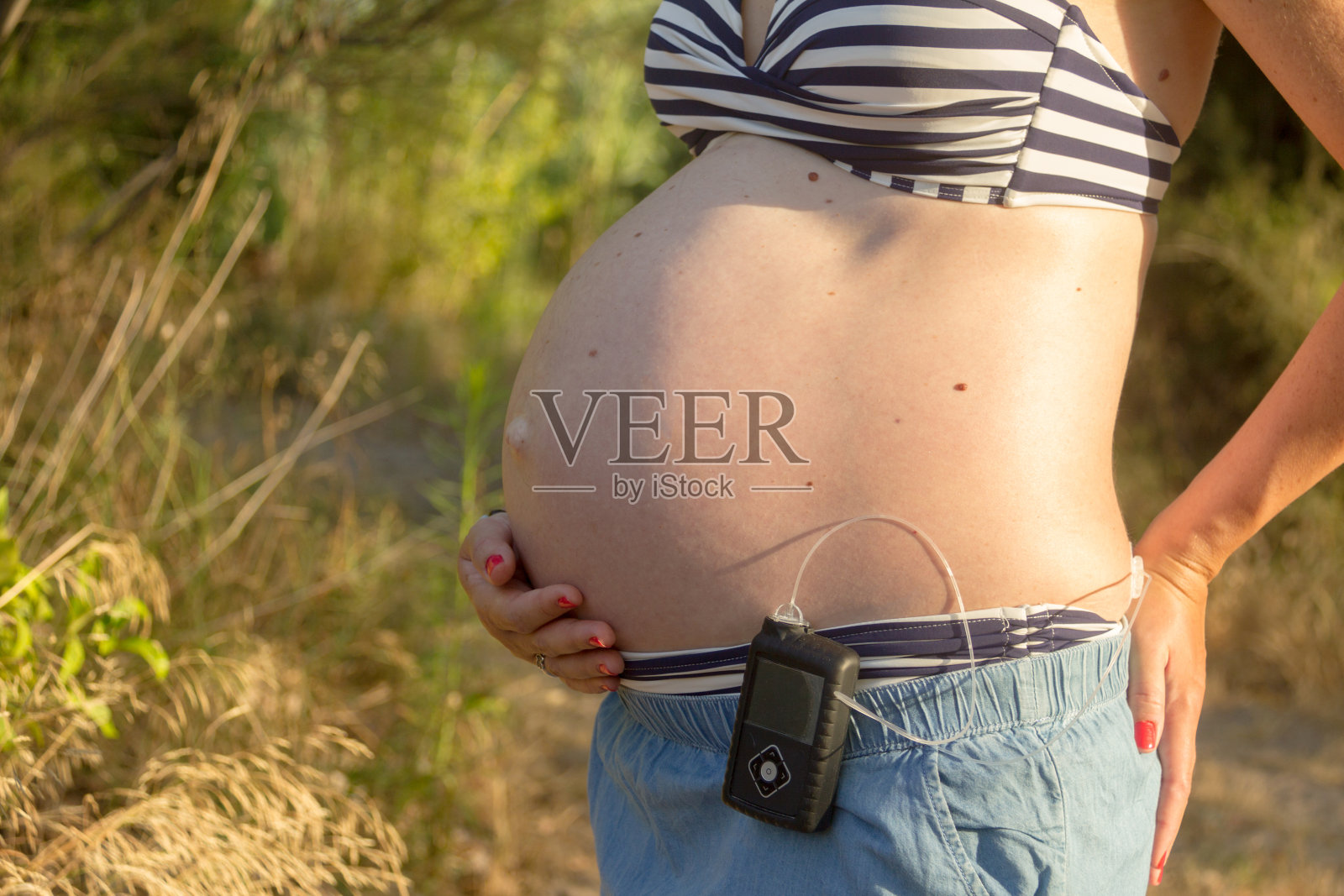 一位患有糖尿病的孕妇在森林里使用胰岛素泵照片摄影图片