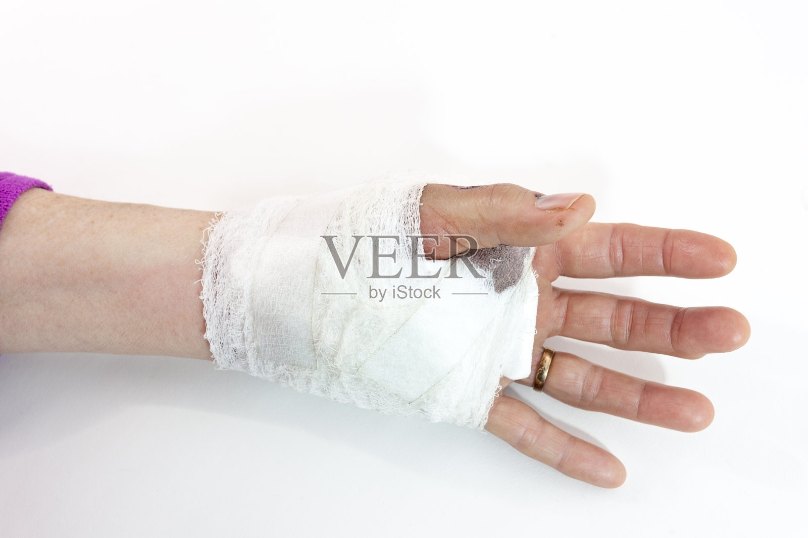 包扎女手照片摄影图片