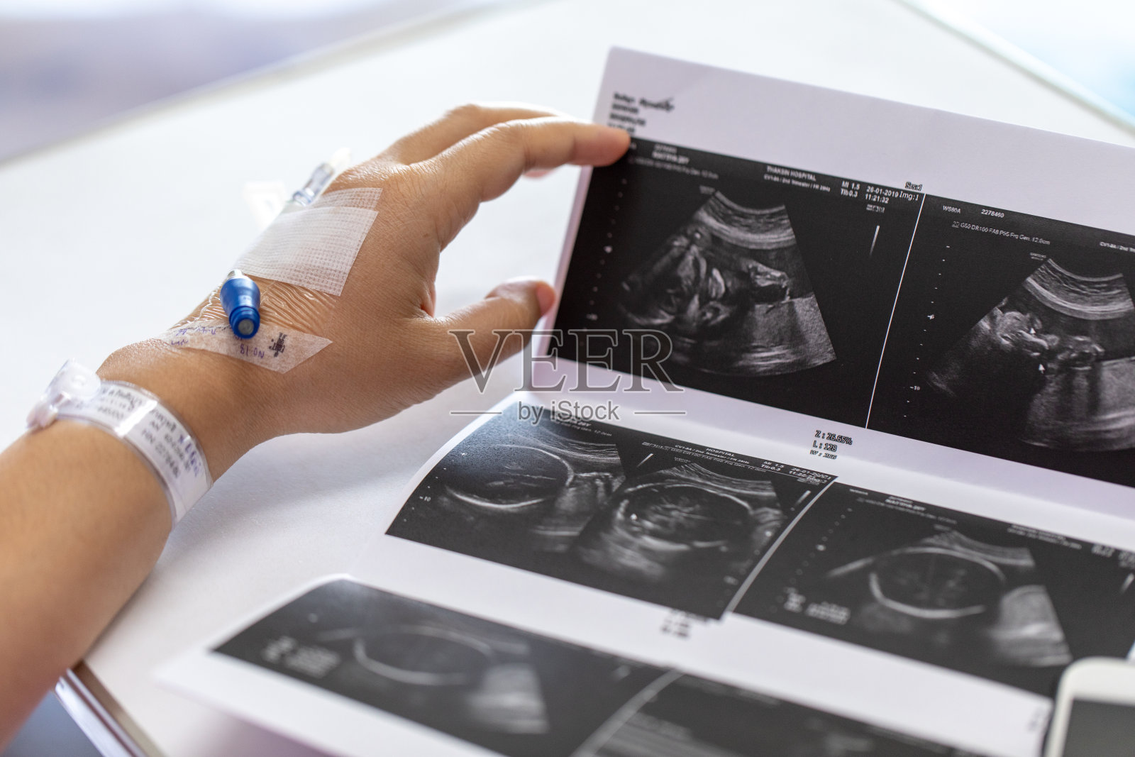 近手妇女患者的手注射生理盐水和躺在医院的康复床上。照片摄影图片