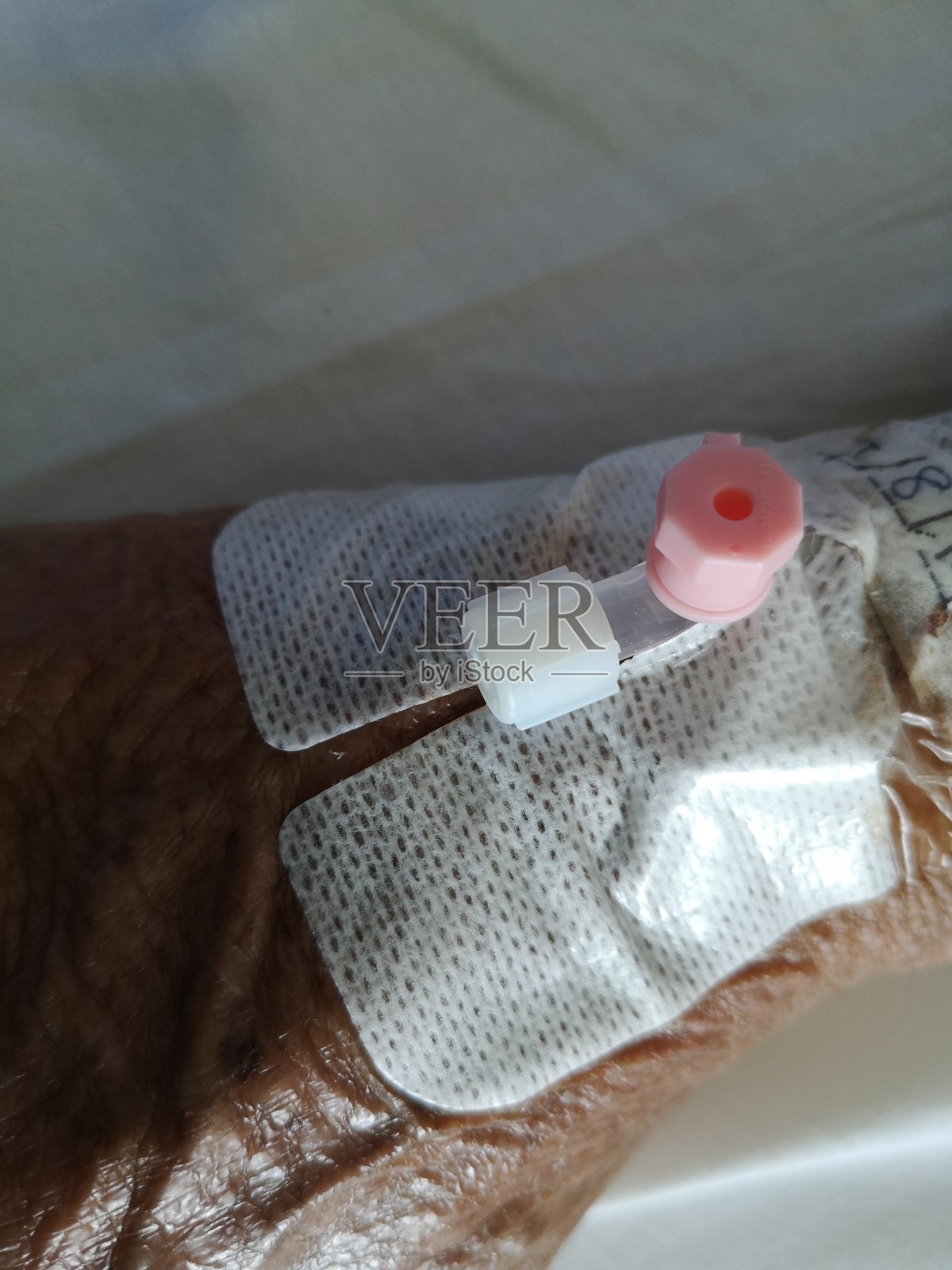 病人正在接受药物治疗并躺在病床上…照片摄影图片