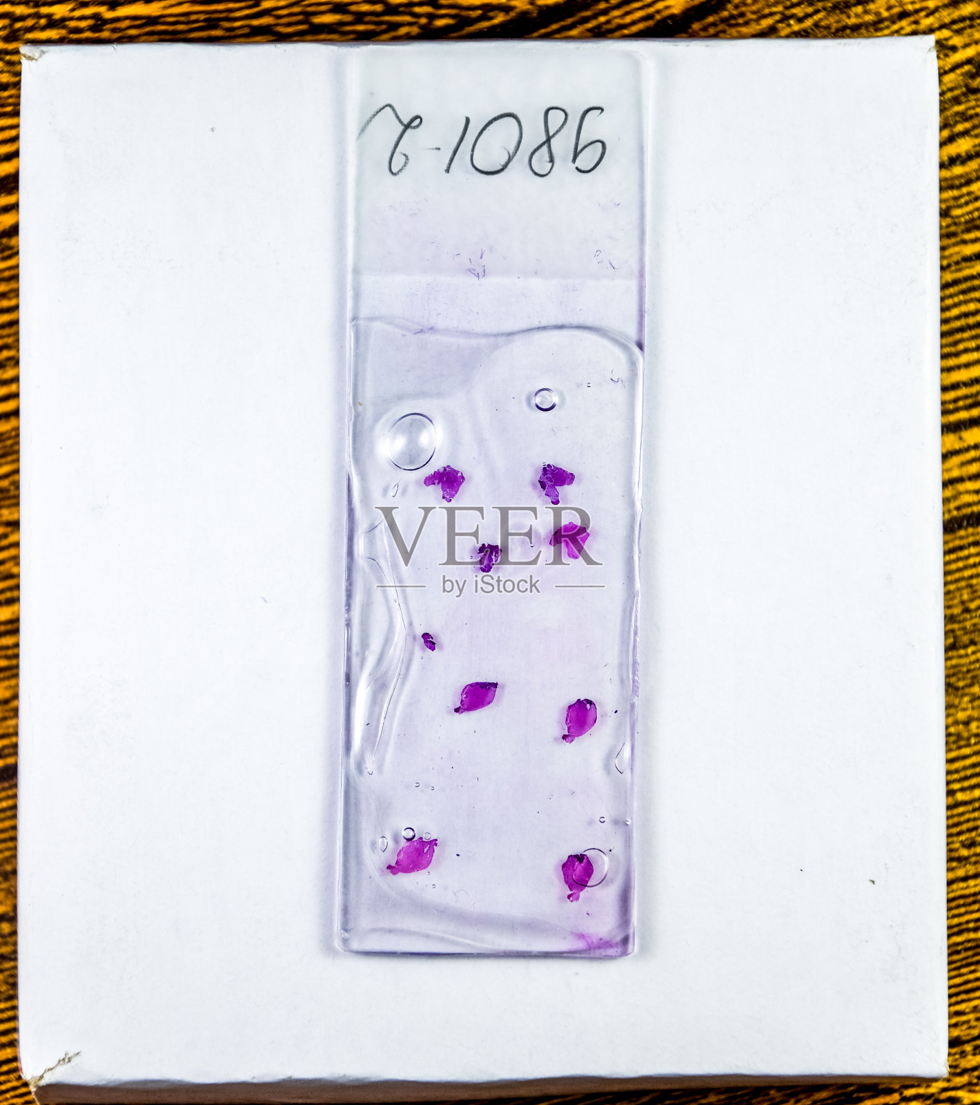 把肿瘤切片放在玻璃下。肿瘤细胞的组织学检查照片摄影图片