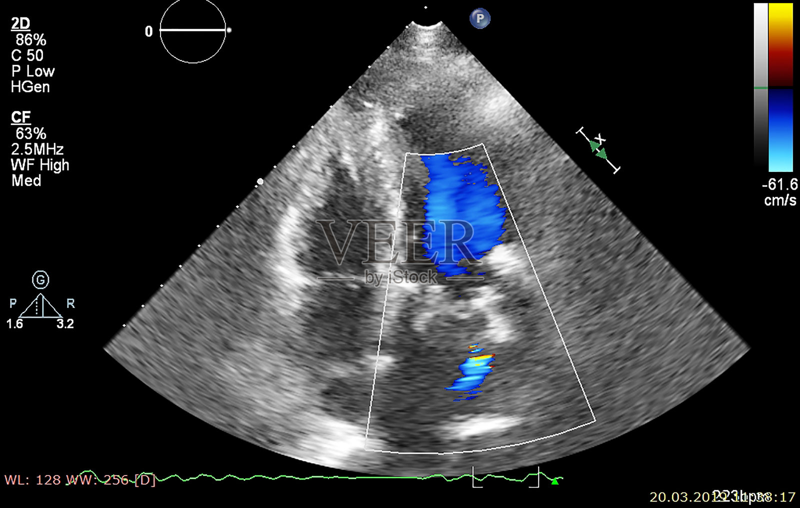 筛查超声心动图(超声)机。照片摄影图片