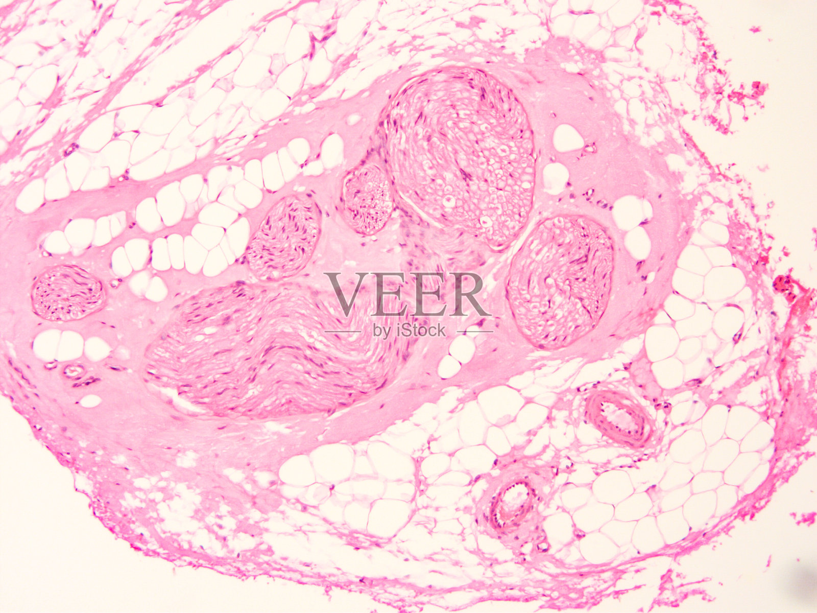 人体组织的组织学照片摄影图片
