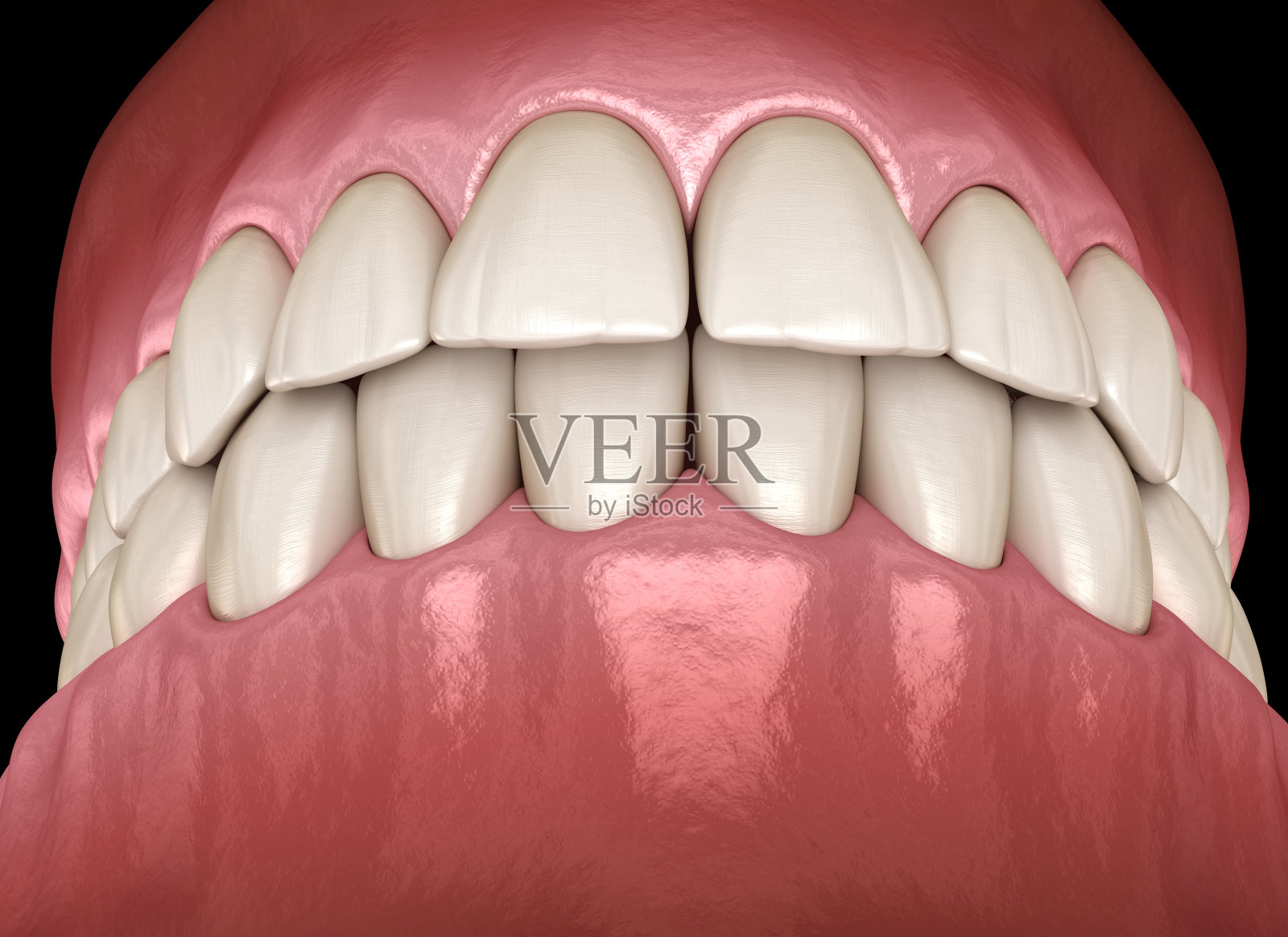 侧面图，正常咬合的健康人类牙齿。医学上准确的牙齿3D插图照片摄影图片
