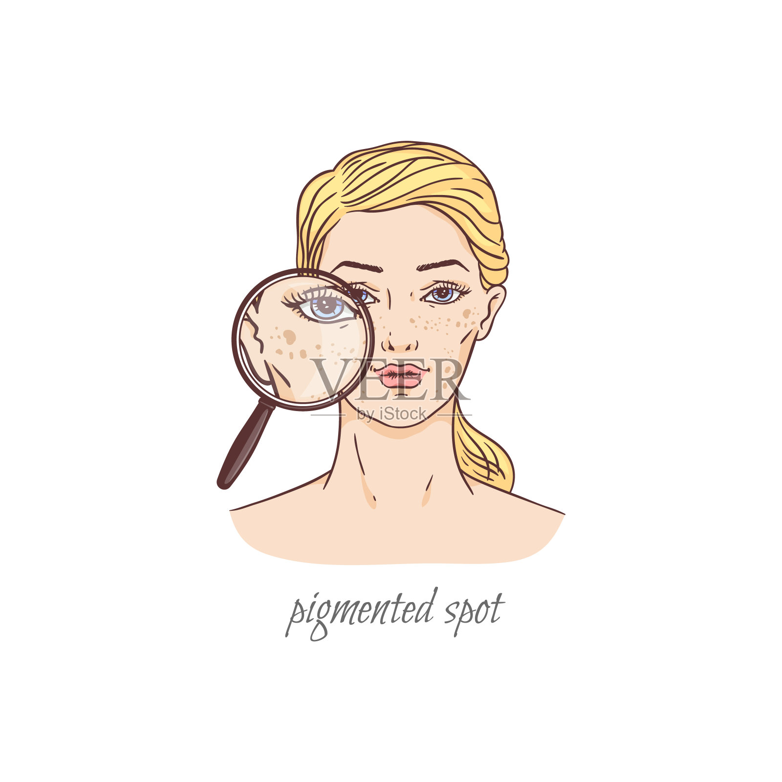 面部色素斑皮肤护理问题-卡通女人的斑点在她的脸颊。插画图片素材
