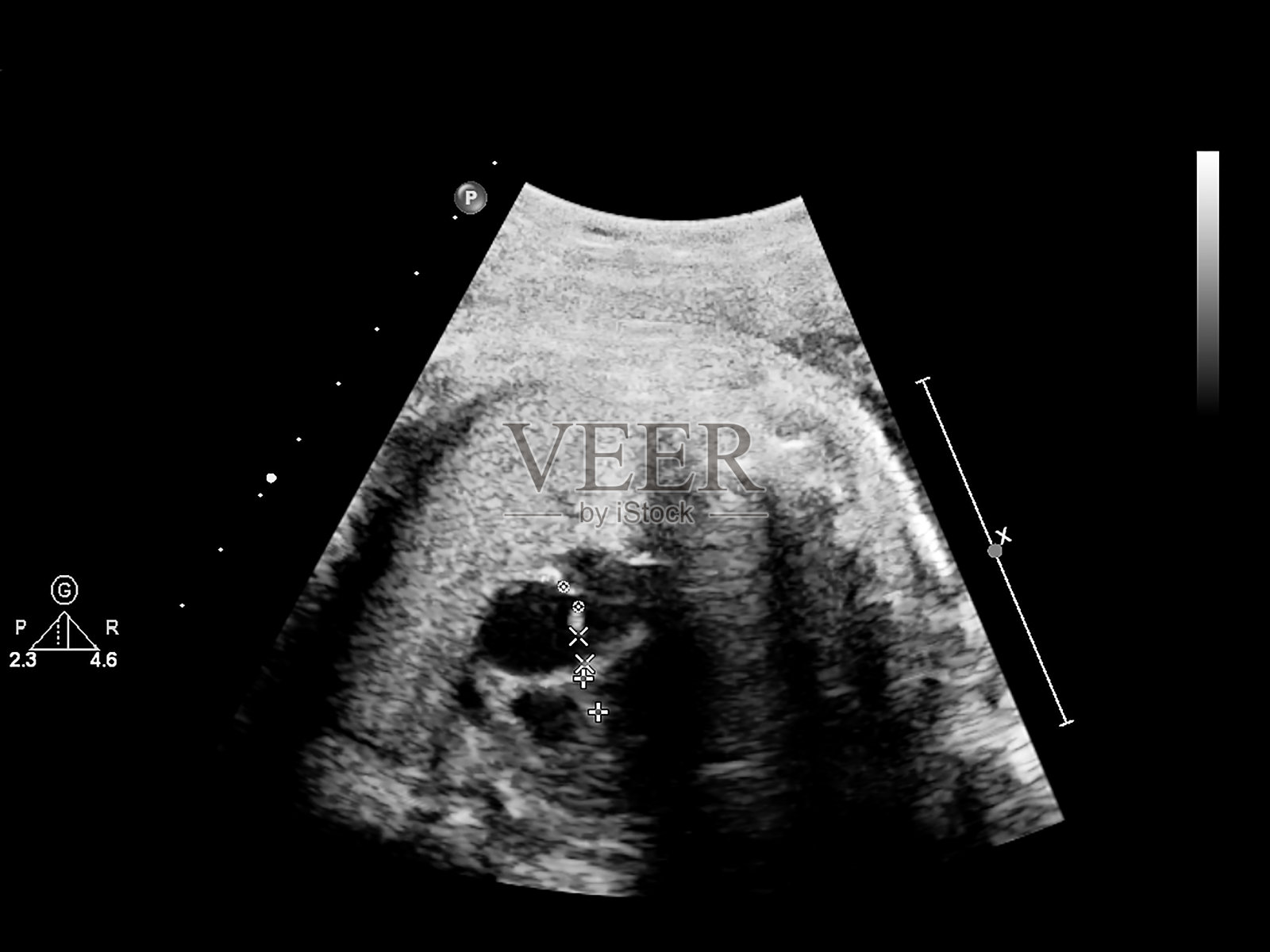 超声筛查胎儿超声心动图。照片摄影图片