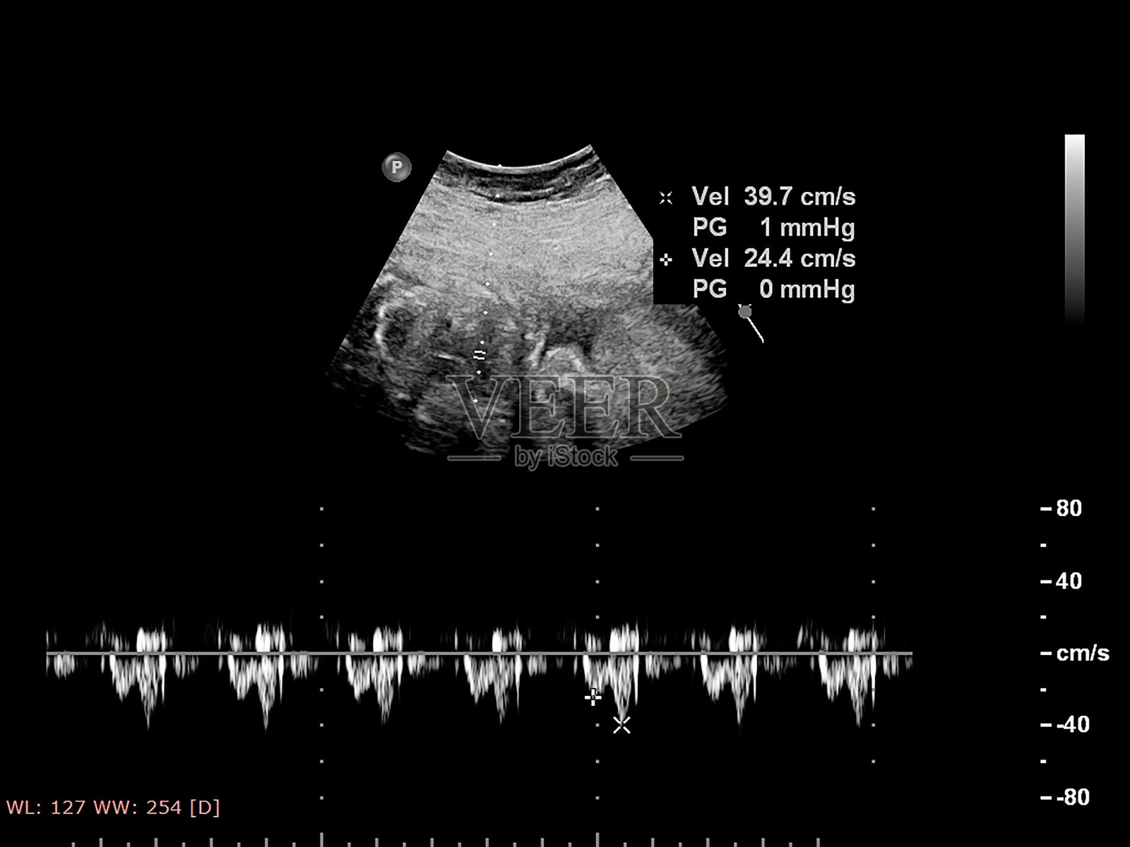 超声筛查胎儿超声心动图。照片摄影图片