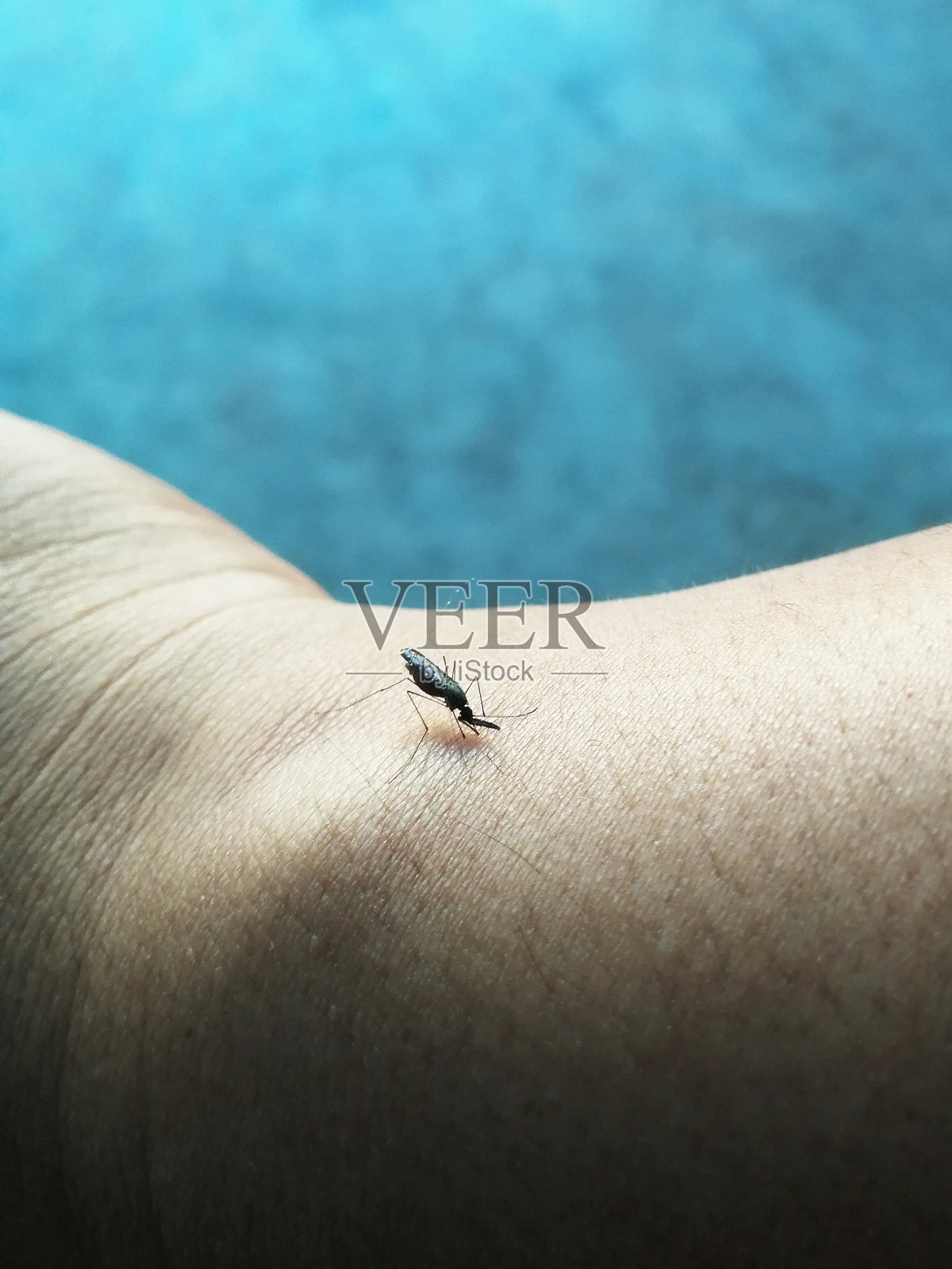 小蚊子咬人的皮肤照片摄影图片