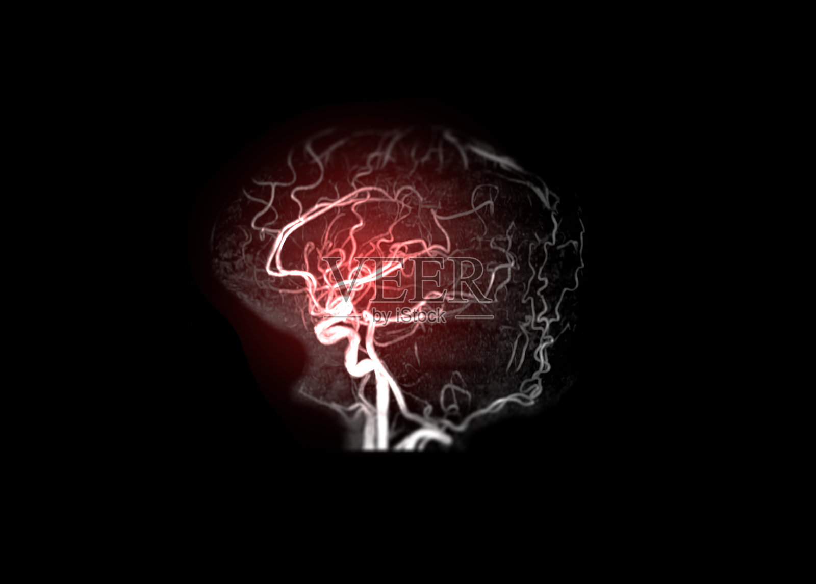 脑动脉磁共振血管造影图像：用于检测中风疾病照片摄影图片