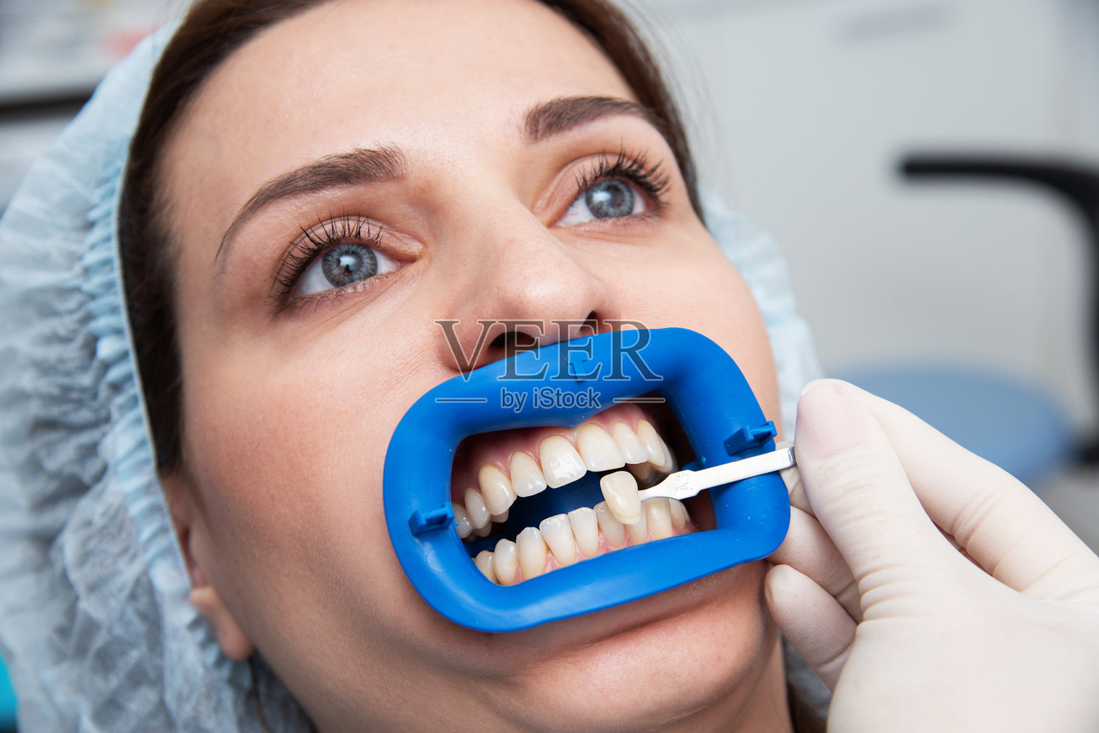 在漂白前用测试方法比较牙齿颜色的方法照片摄影图片