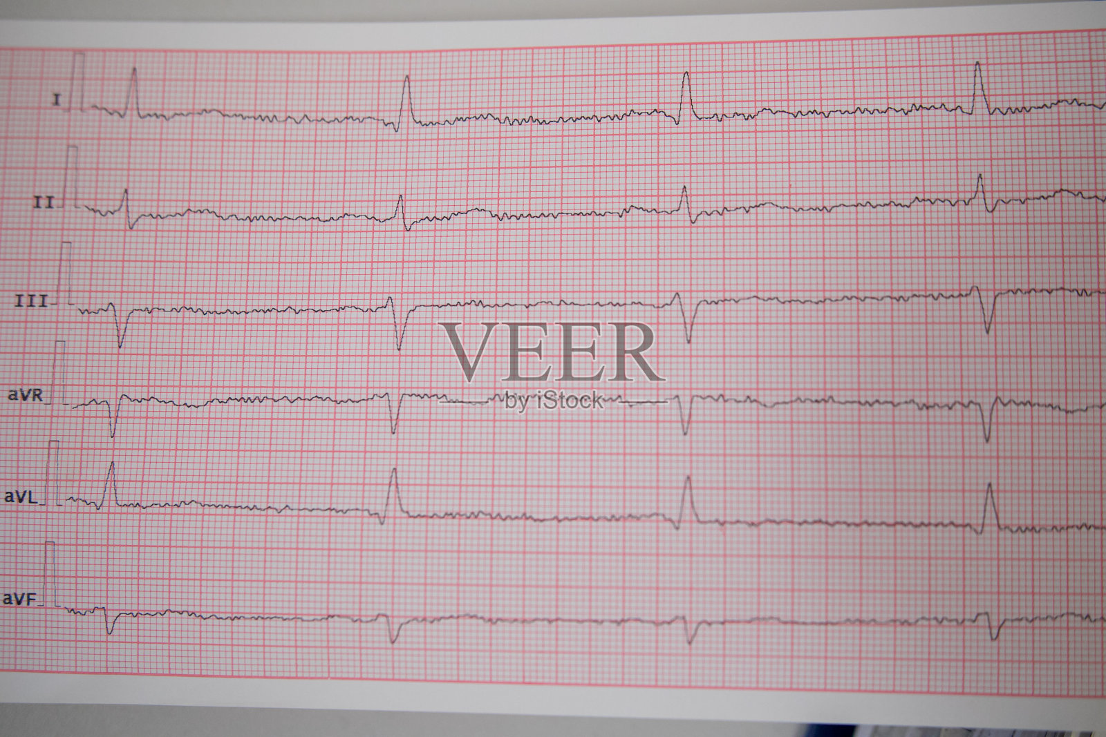 准备。身穿白袍的医生正在为病人做心电图准备照片摄影图片