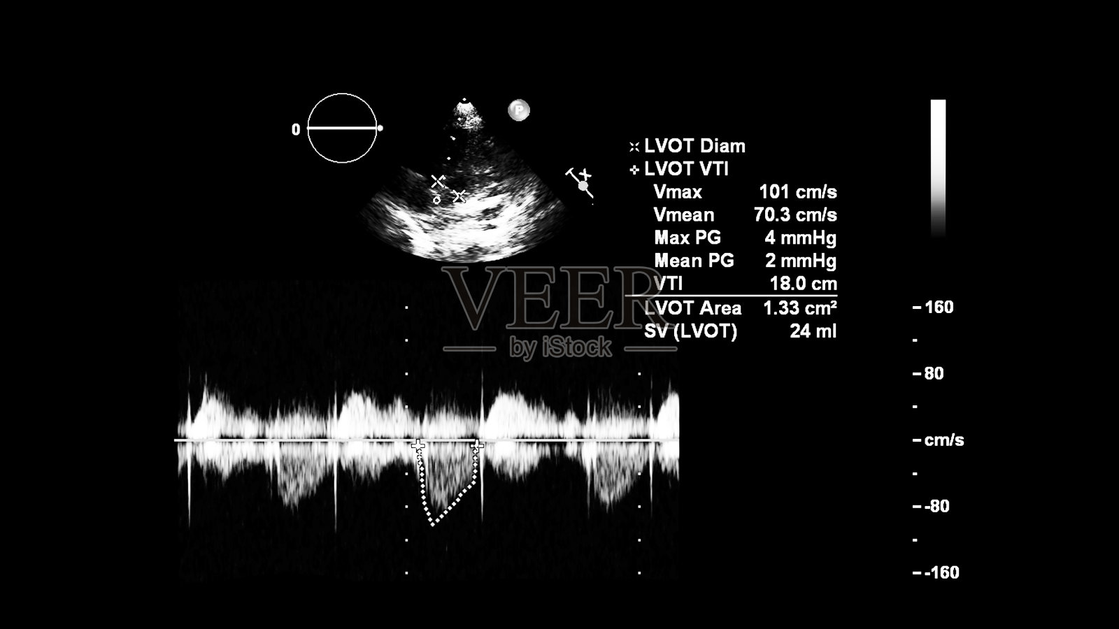 经食管超声检查心脏图像。照片摄影图片