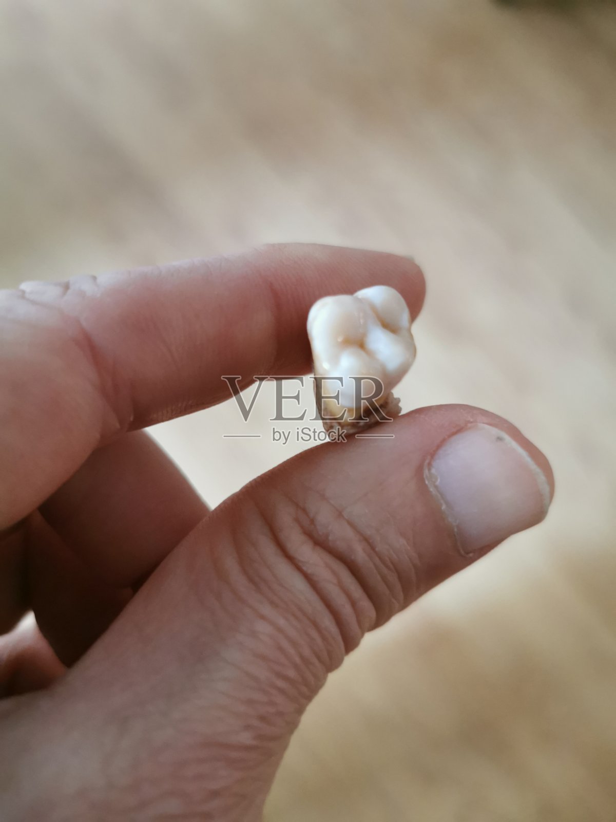 男人露出掉落的牙齿照片摄影图片