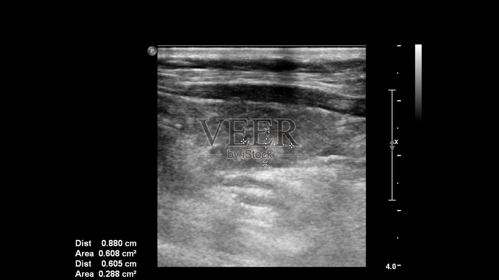 血管超声波检查。照片摄影图片