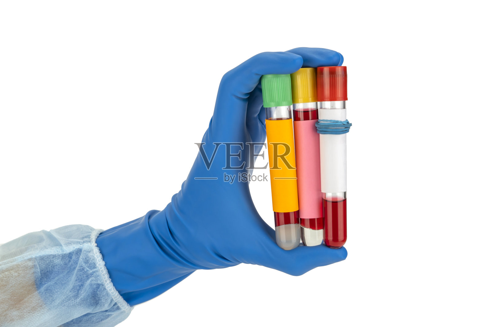 手持真空采血管中的血液样本，新型冠状病毒检测呈阳性照片摄影图片