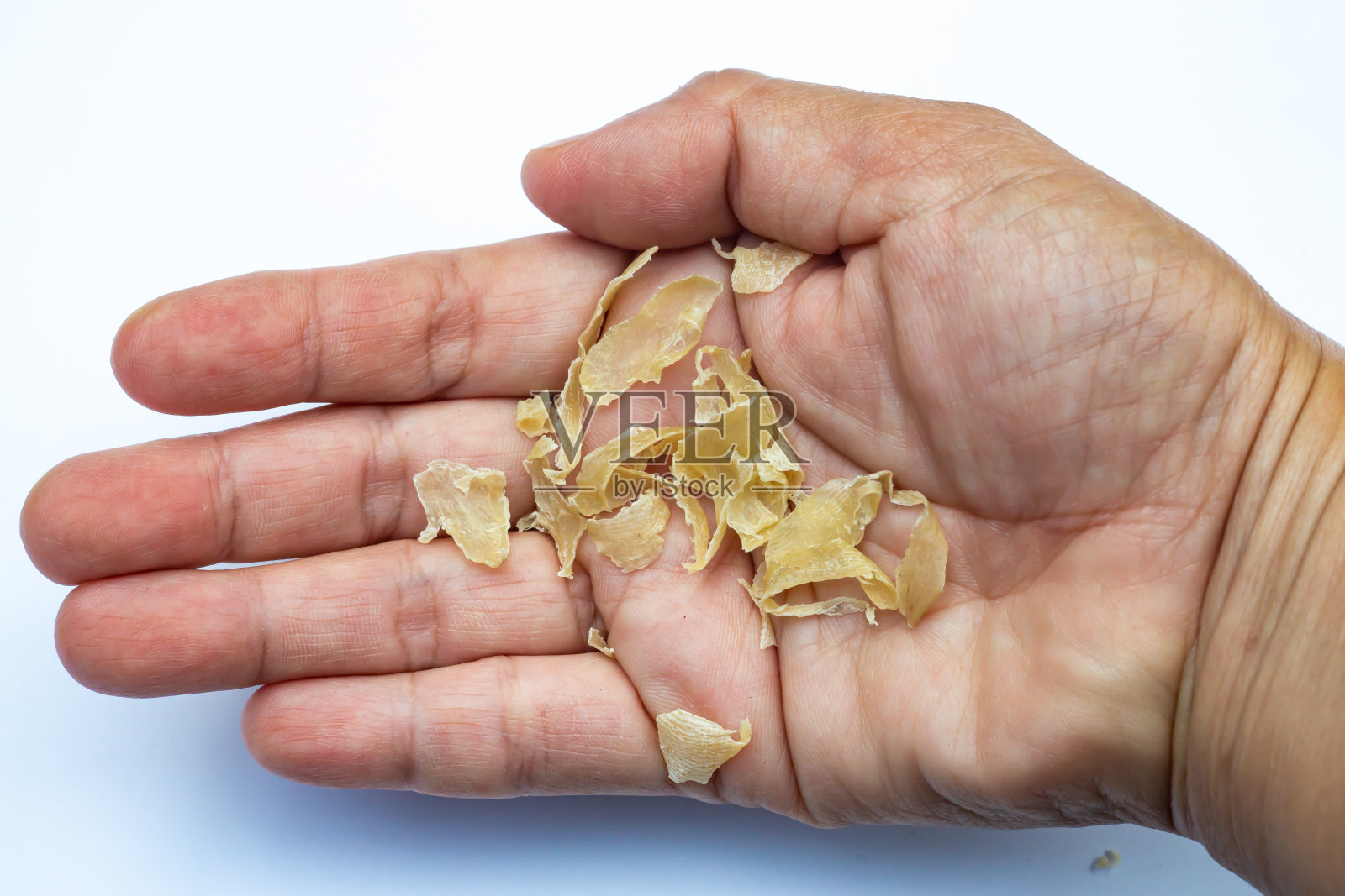 女性手部特写：脚后跟皮肤破裂脱落，足部皮炎，白色背景，医疗保健概念照片摄影图片