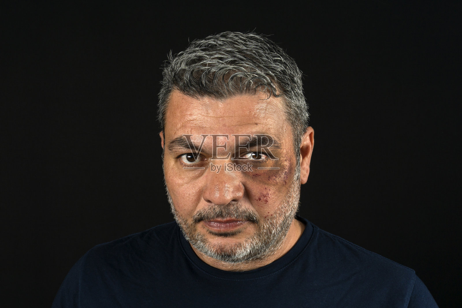 面部受伤的成熟男子的肖像照片摄影图片