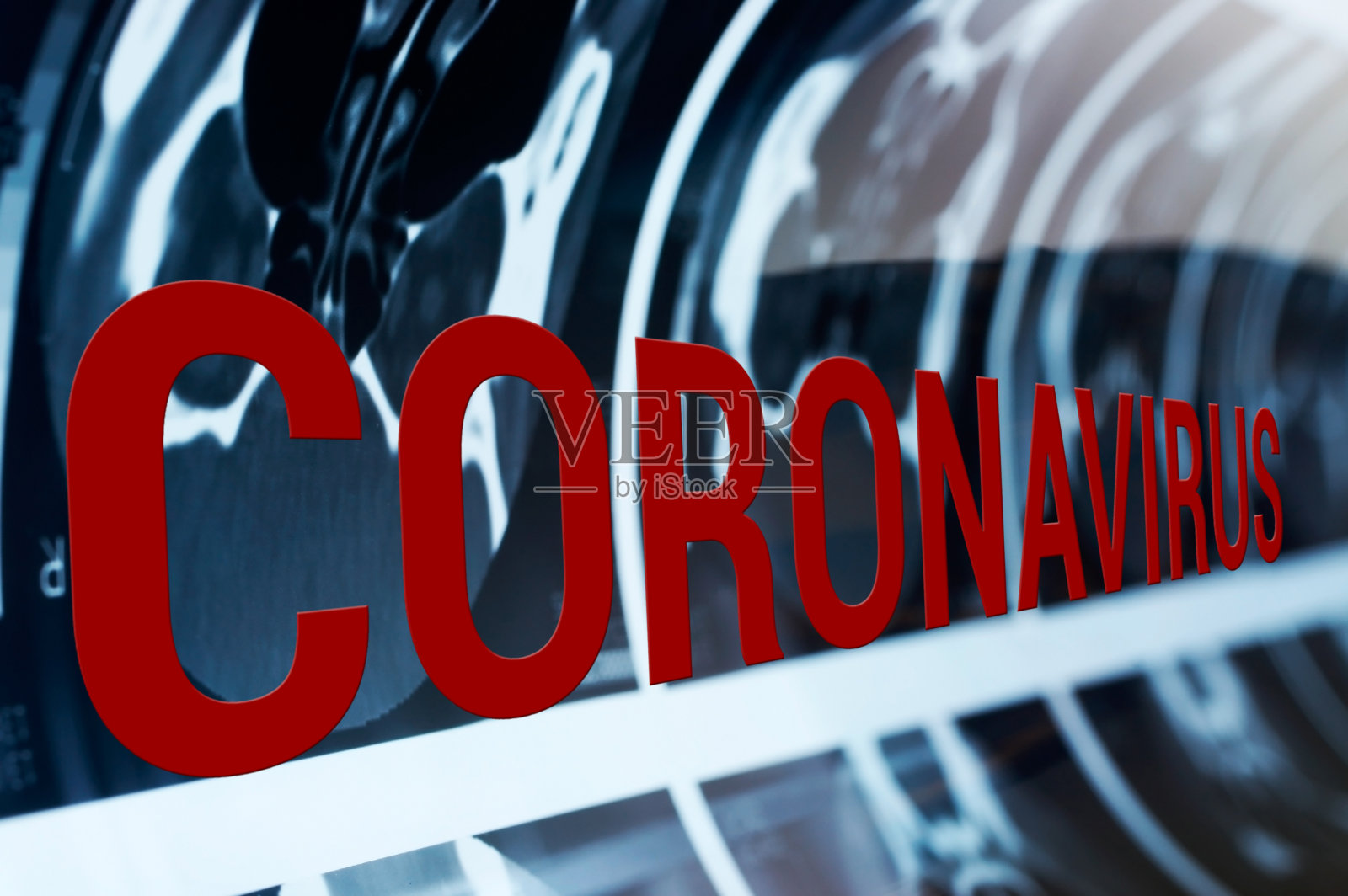 冠状病毒诊断x线cat断层扫描结果照片摄影图片