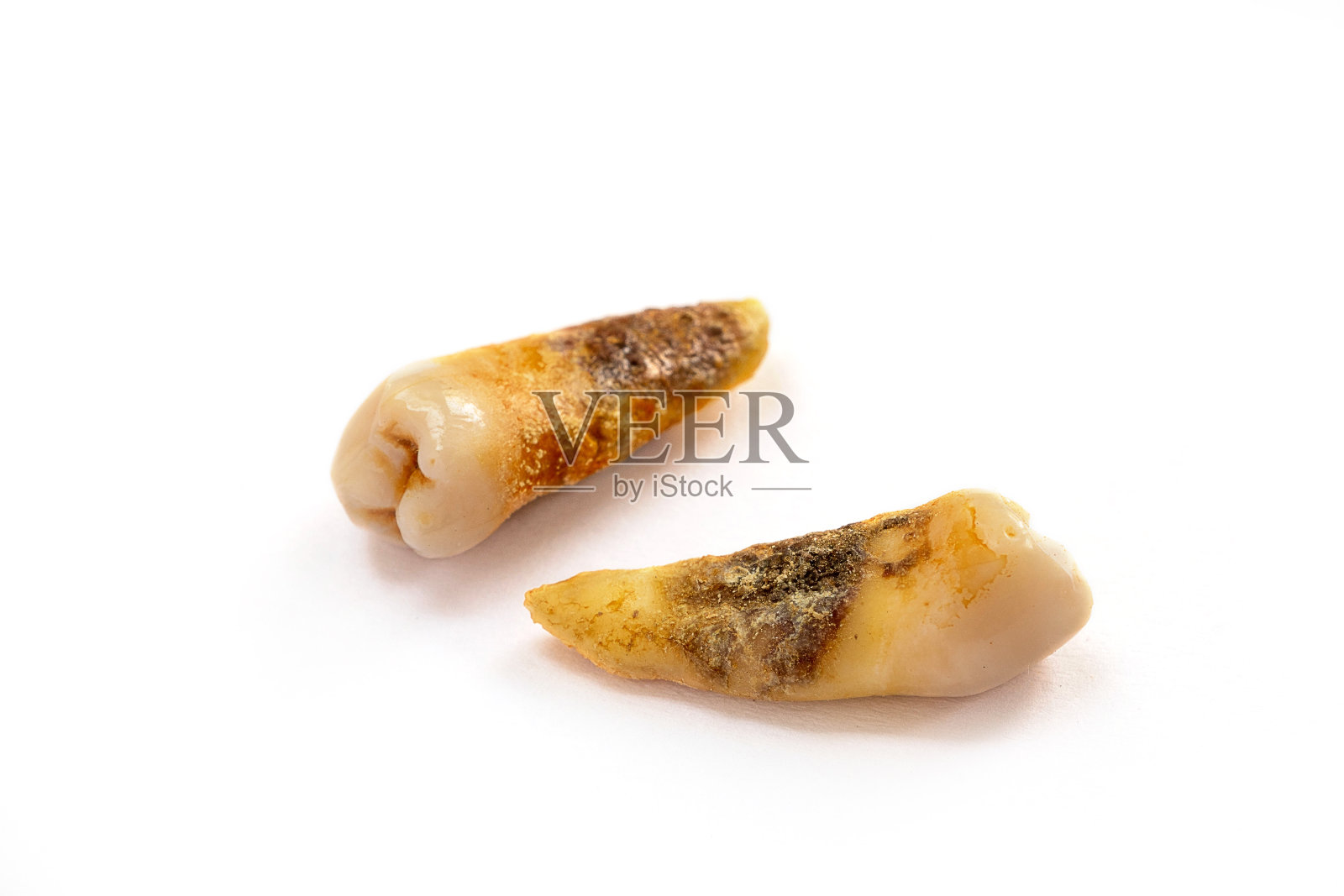 有严重蛀牙的近距离牙齿照片摄影图片