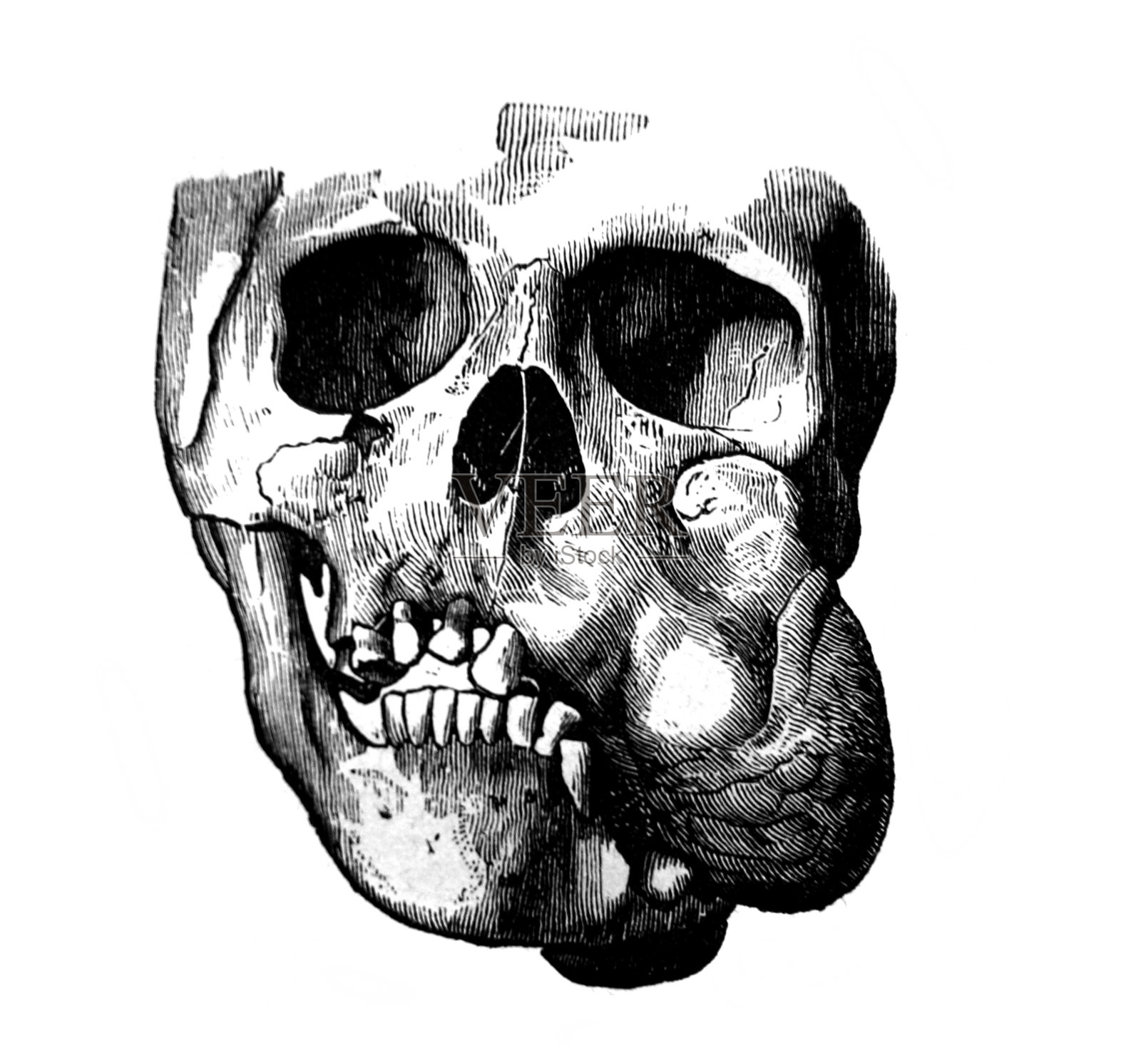 上颌骨外骨骼周长3分米在《外科解剖学》的旧书中，作者是B. Anger, 1869年，巴黎插画图片素材