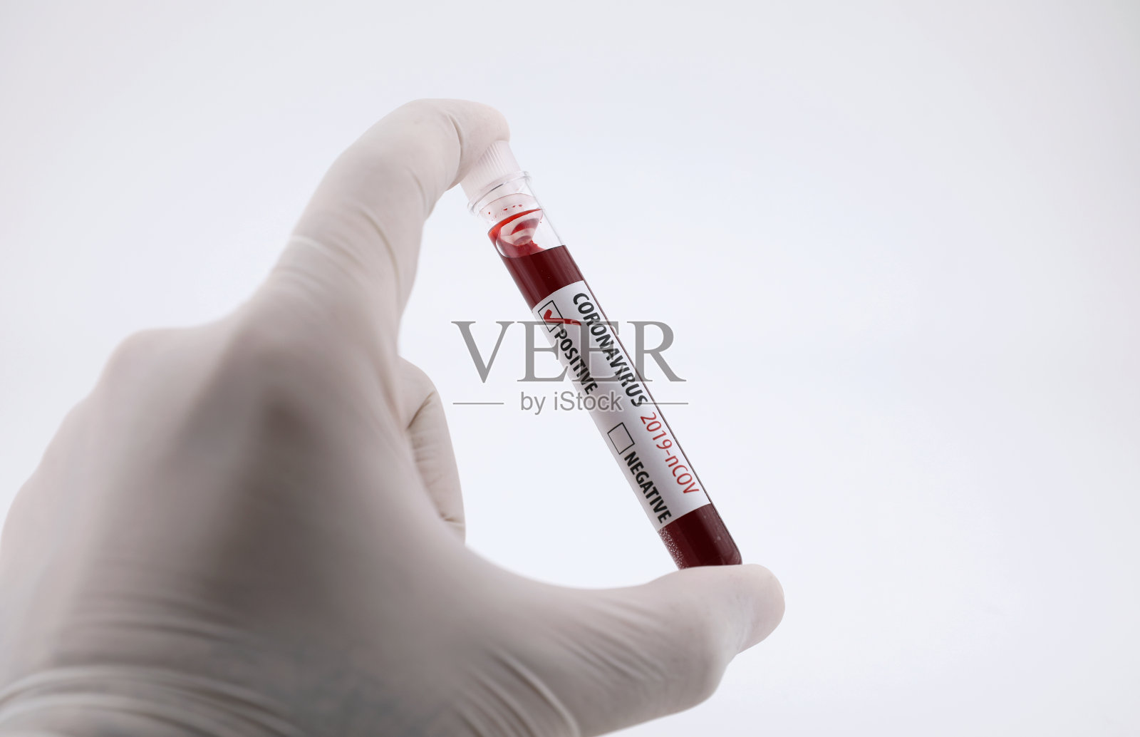 冠状病毒血液检测阳性照片摄影图片