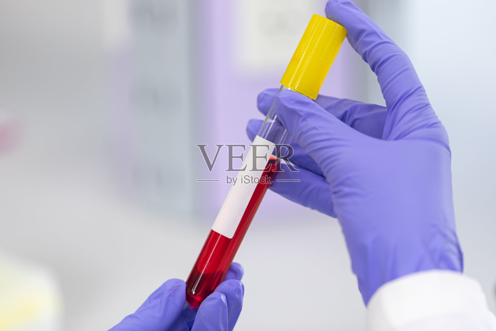 在实验室分析和研究冠状病毒疾病(CoV)疫苗照片摄影图片