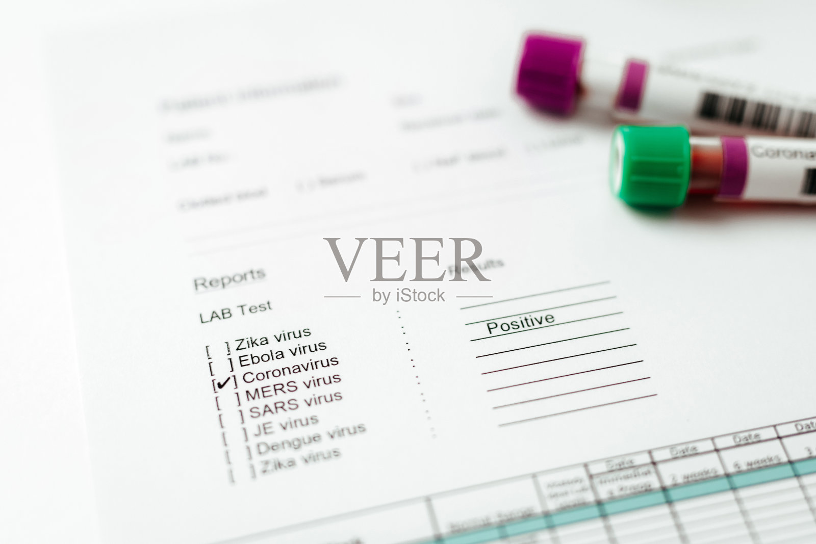 两支冠状病毒血液试管及检测结果照片摄影图片