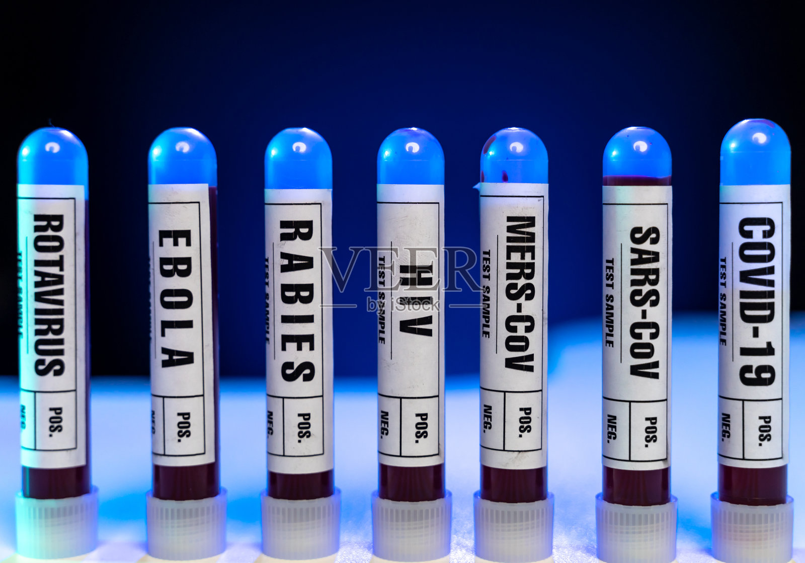 轮状病毒、埃博拉病毒、狂犬病毒、艾滋病毒、中东呼吸综合征冠状病毒、严重急性呼吸综合征冠状病毒、新冠病毒血液测试样本管照片摄影图片