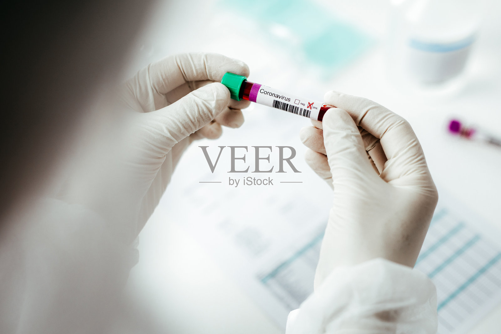 手持新冠病毒阳性血液试管照片摄影图片