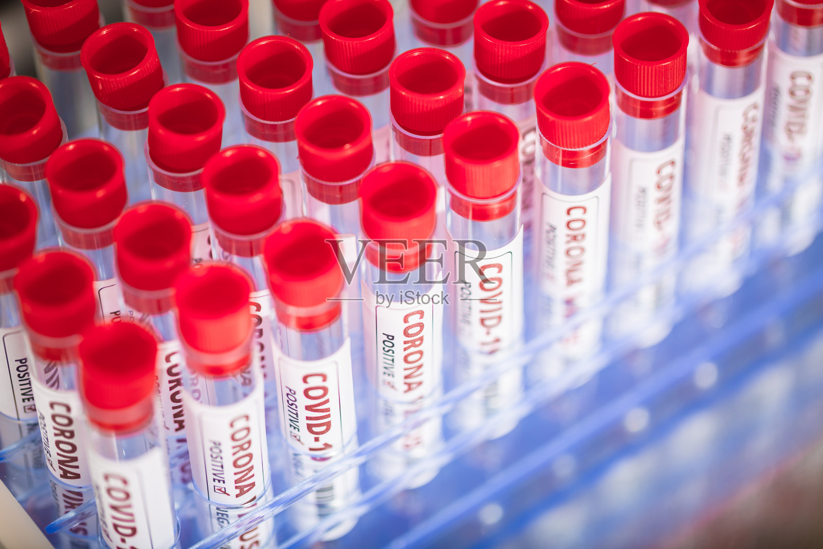 血液试管用于新型冠状病毒分析。冠状病毒血液检测概念库存照片照片摄影图片