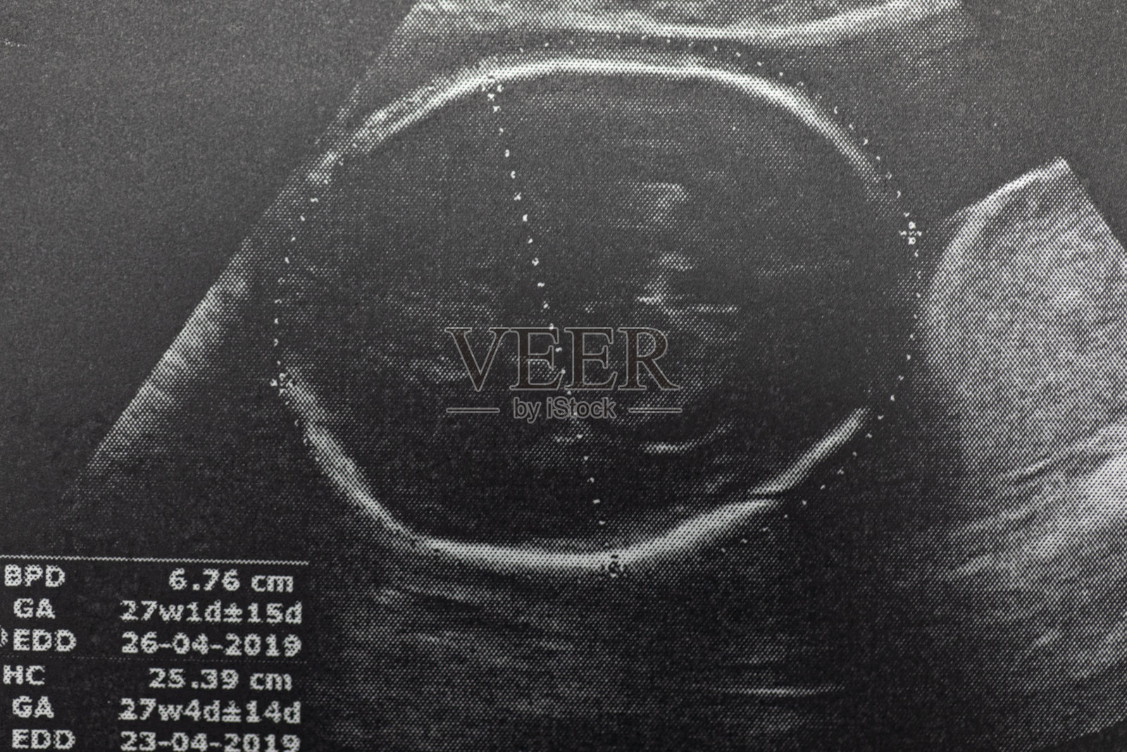 孕妇胎儿超声检查，医生通过超声读取孕妇检测结果。照片摄影图片