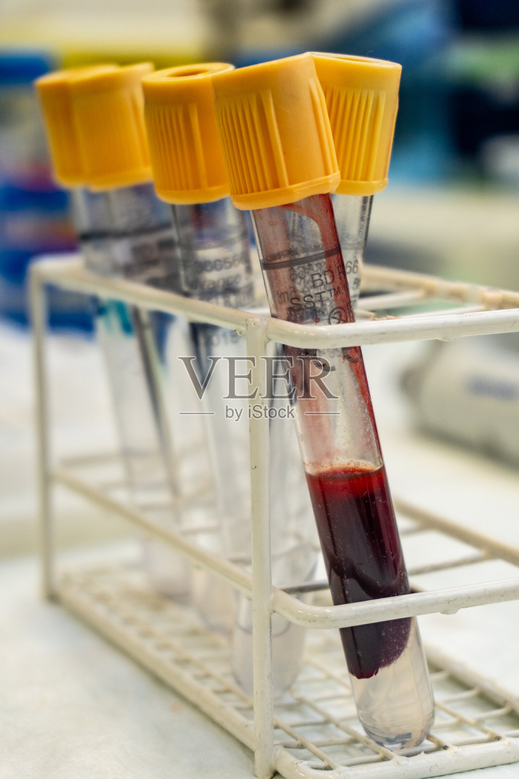 真空容器中的血样照片摄影图片