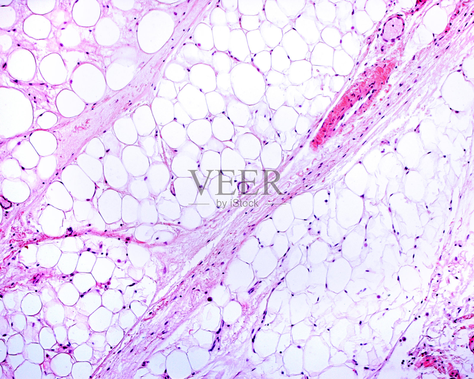 脂肪组织照片摄影图片