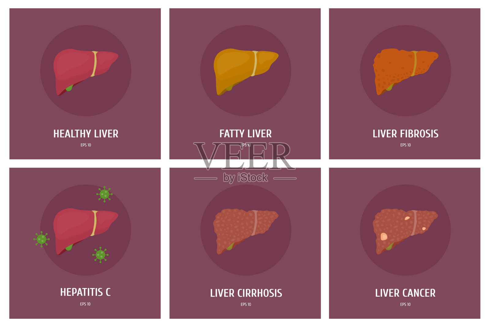 一套健康的肝脏及其各种疾病:肝炎、癌症、肥胖症、肝硬化。插画图片素材