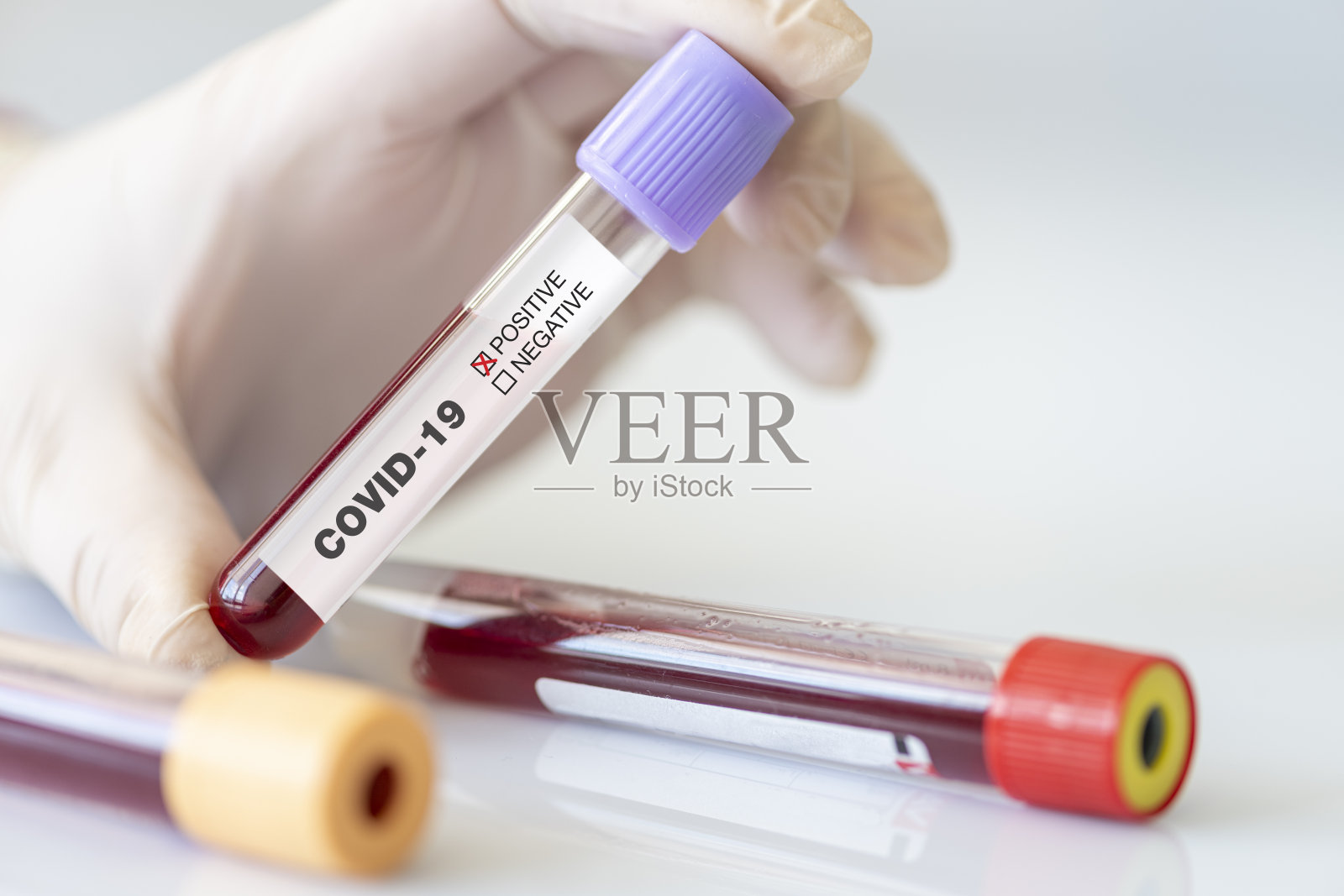 冠状病毒血液检测。实验室冠状病毒阳性血液照片摄影图片