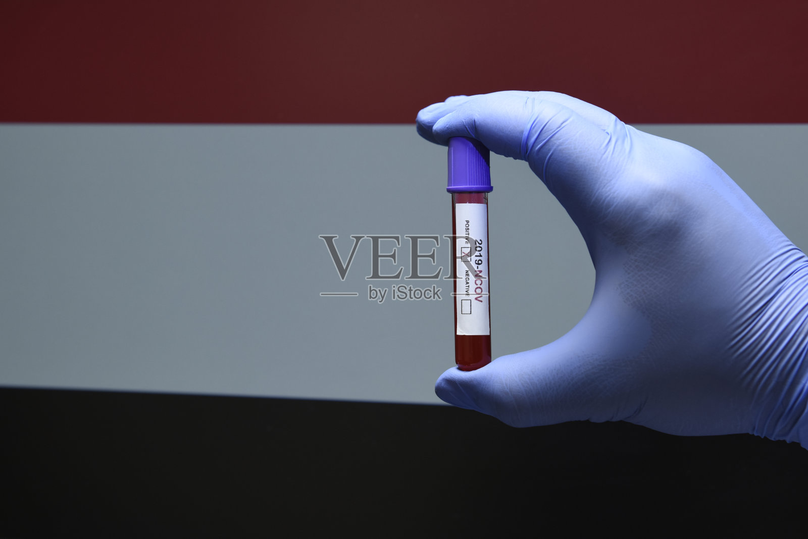 也门的新冠病毒或COVID-19，手持带有也门国旗背景的血液样本试管照片摄影图片